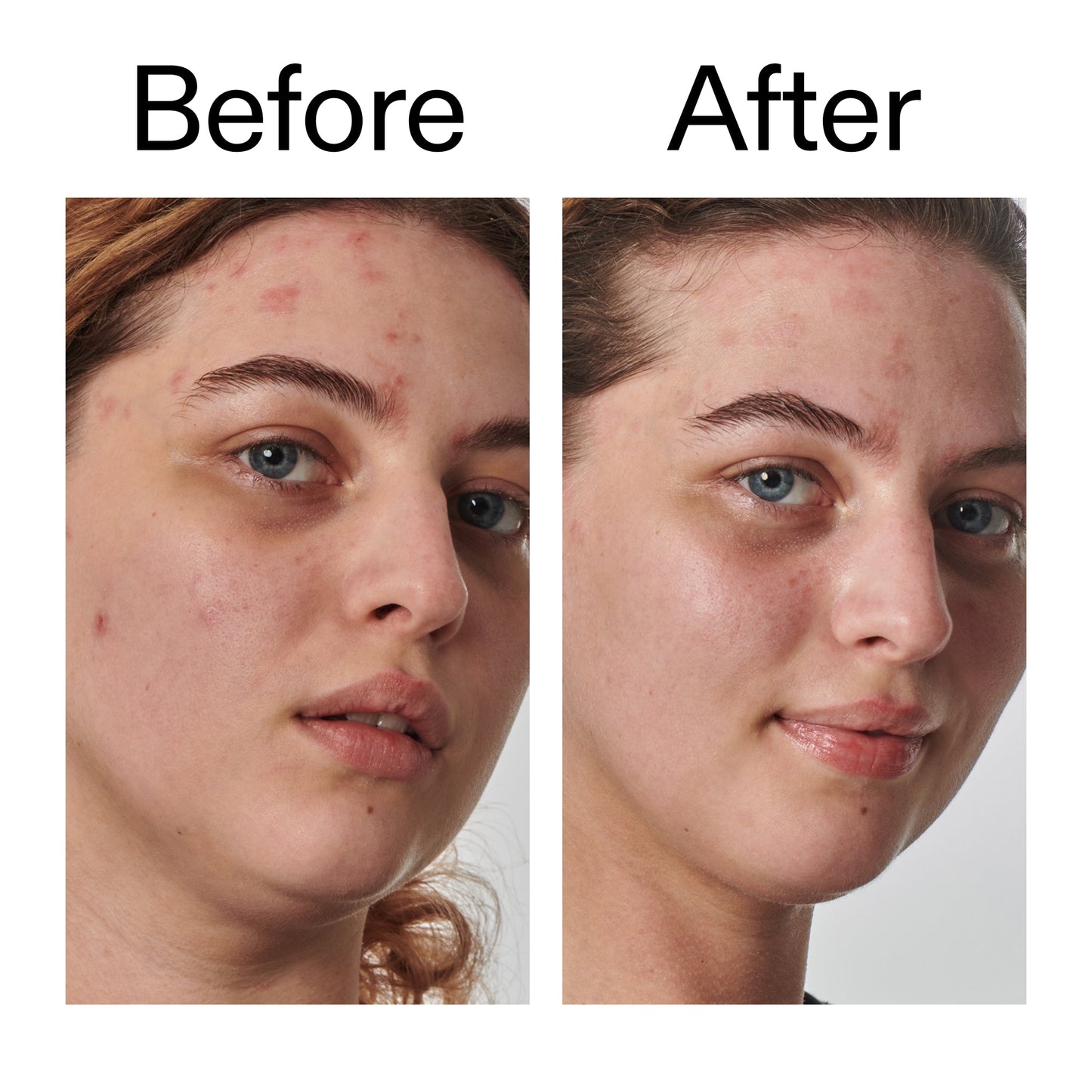 10-urea-moisturizer-u3 Dry_and_Rough_Skin_Solution_Before_After_2000x2000_efa6e639-5c39-49bd-a5dd-f0220293120a.jpg