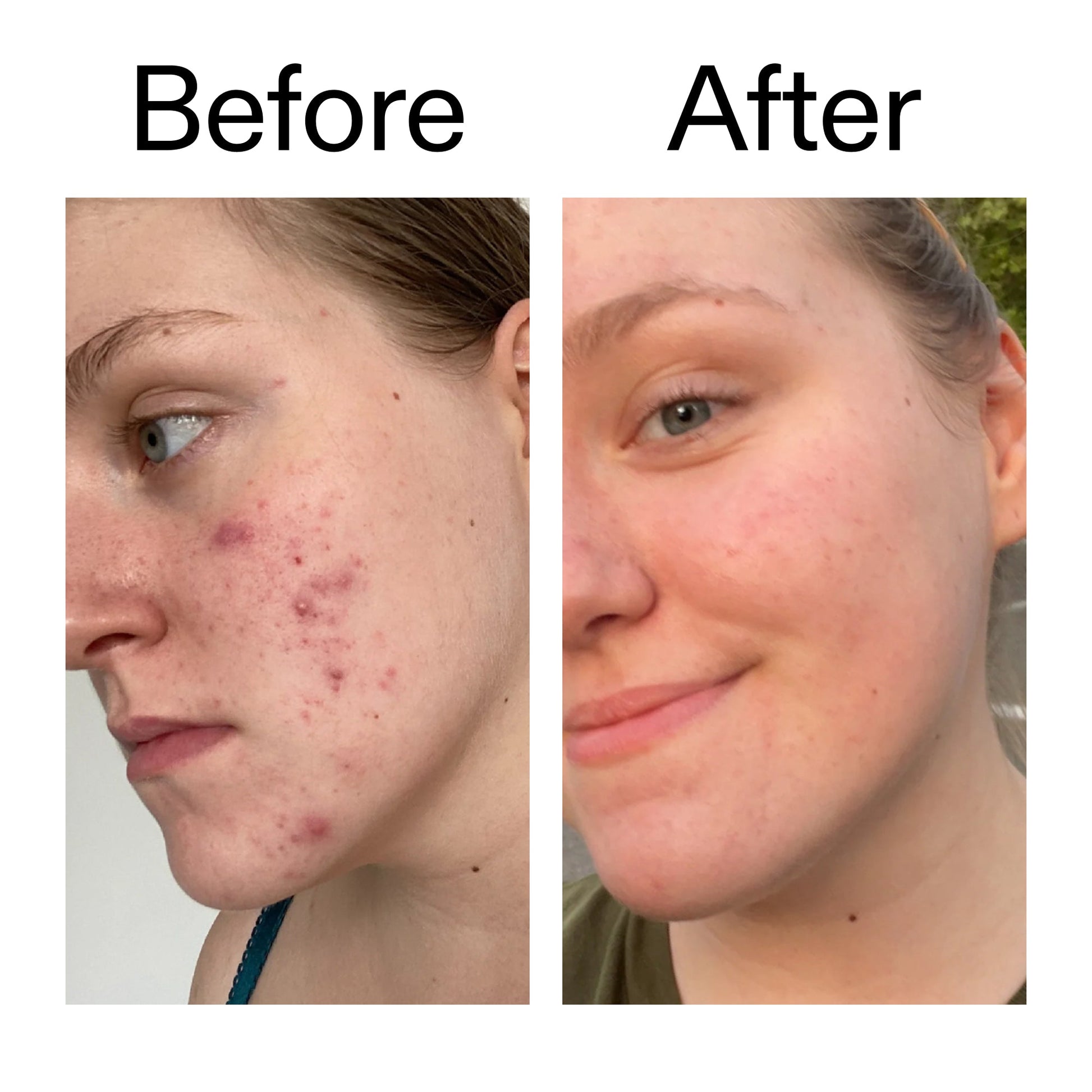 15-vitamin-c-egf-serum-g6 15_Vitamin_C_EGF_Serum_Before_After_2000x2000_fb9f598a-3386-40c8-8143-36f9d7a17ec8.jpg
