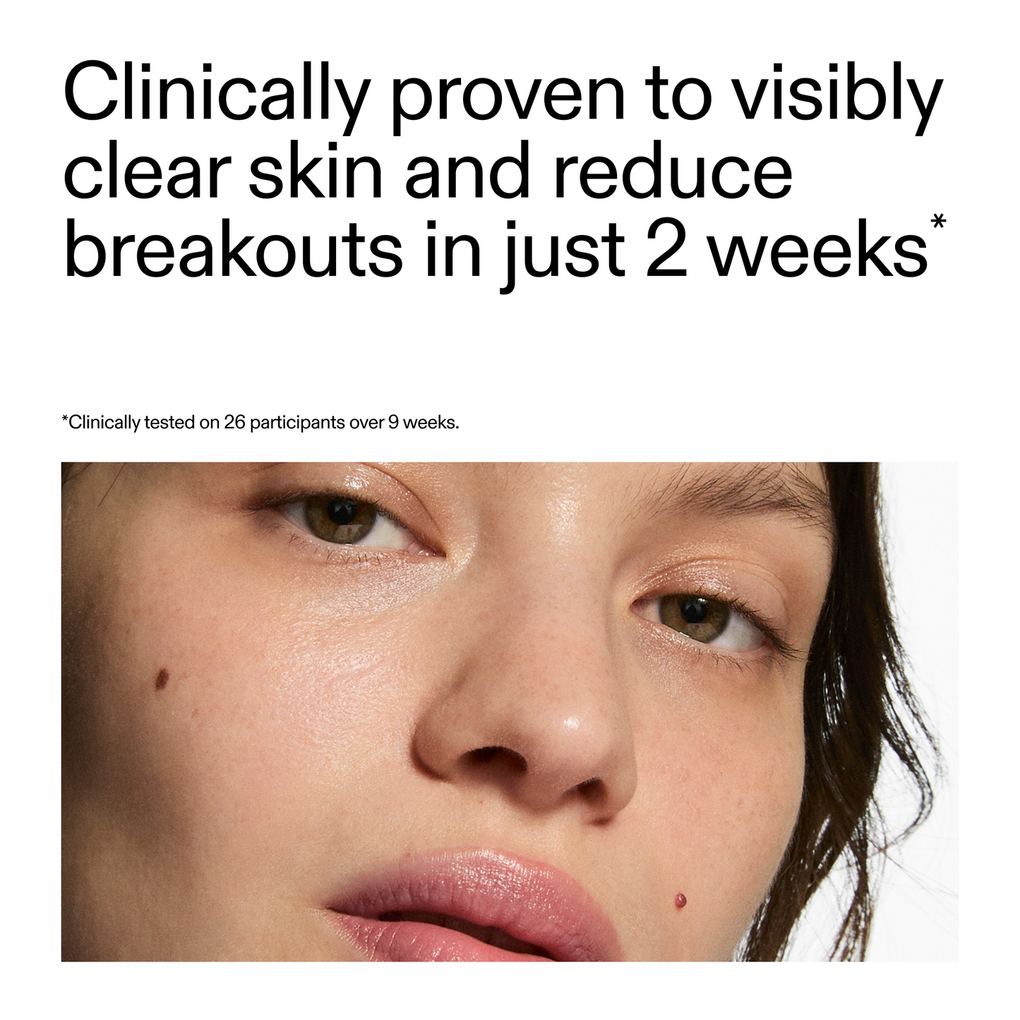 360-acne-clearing-duo-q7 360_Serum_Key_Claim.png