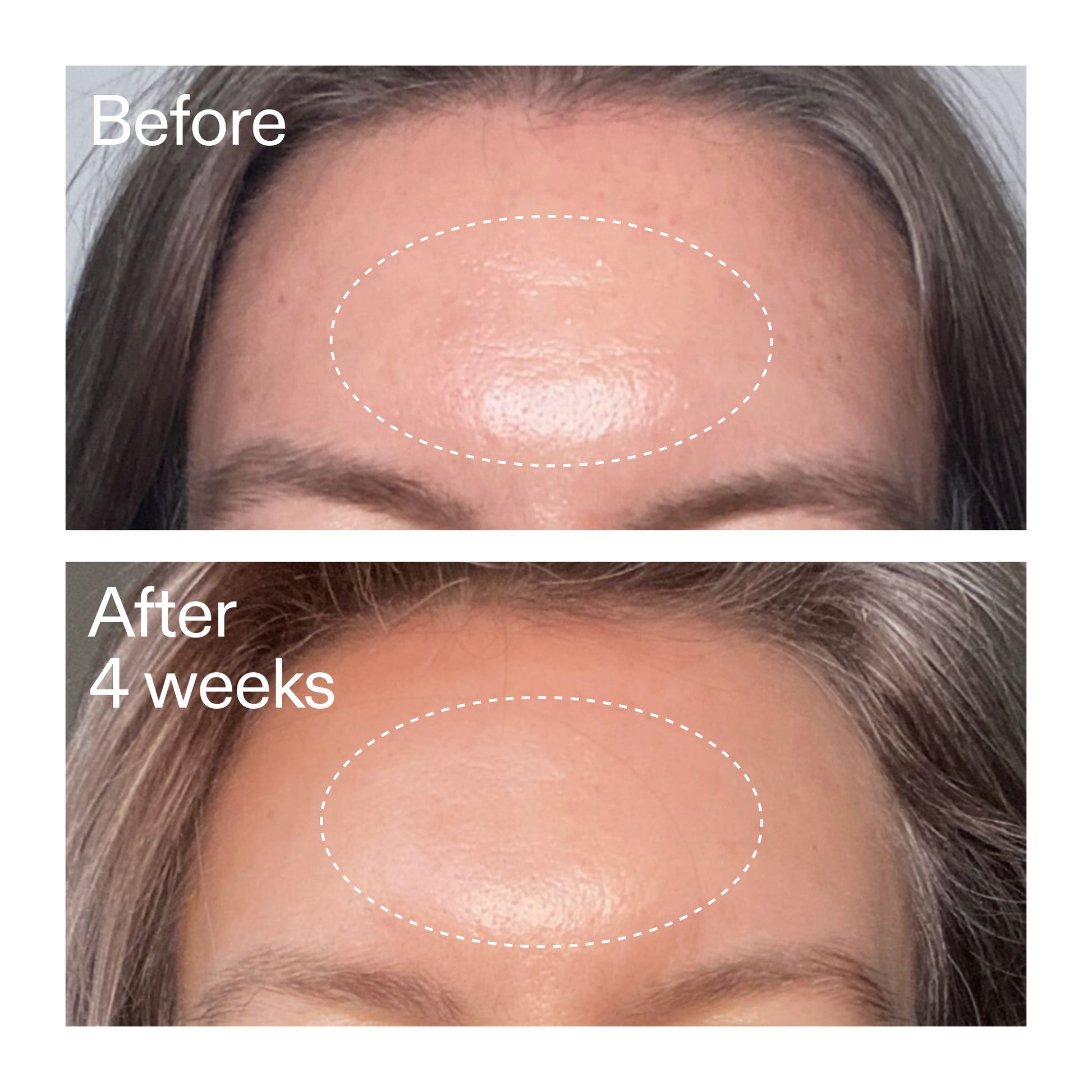 advanced-0-2-retinal-serum-k5 AdvancedRetinal_BeforeAfter1_2000x2000_1da6bb0a-29dd-41d1-95b7-8679696bbf0f.jpg