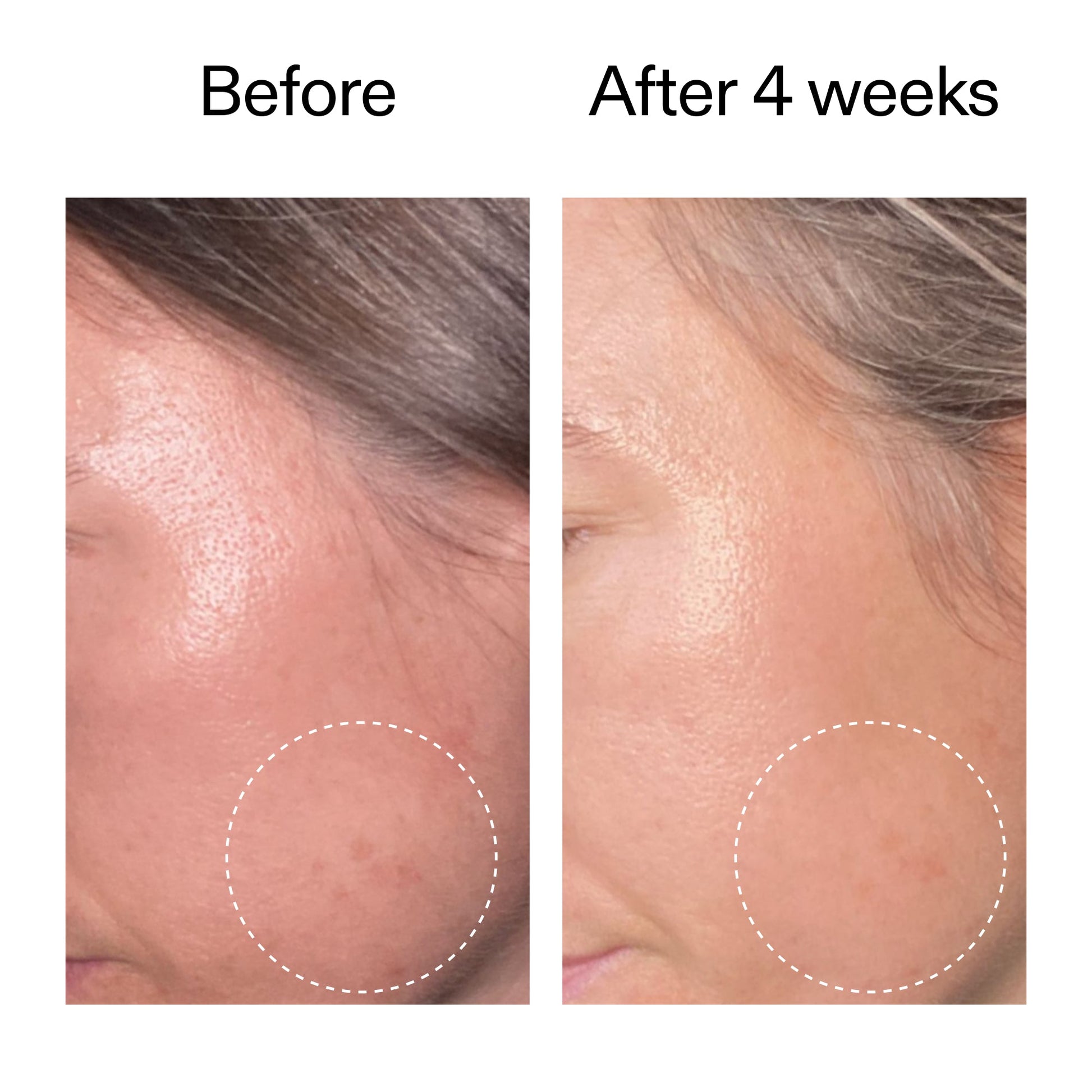 advanced-0-2-retinal-serum-k5 AdvancedRetinal_BeforeAfter2__2000x2000_62fb16bb-77ae-4d63-8500-88dbf847f4b9.jpg