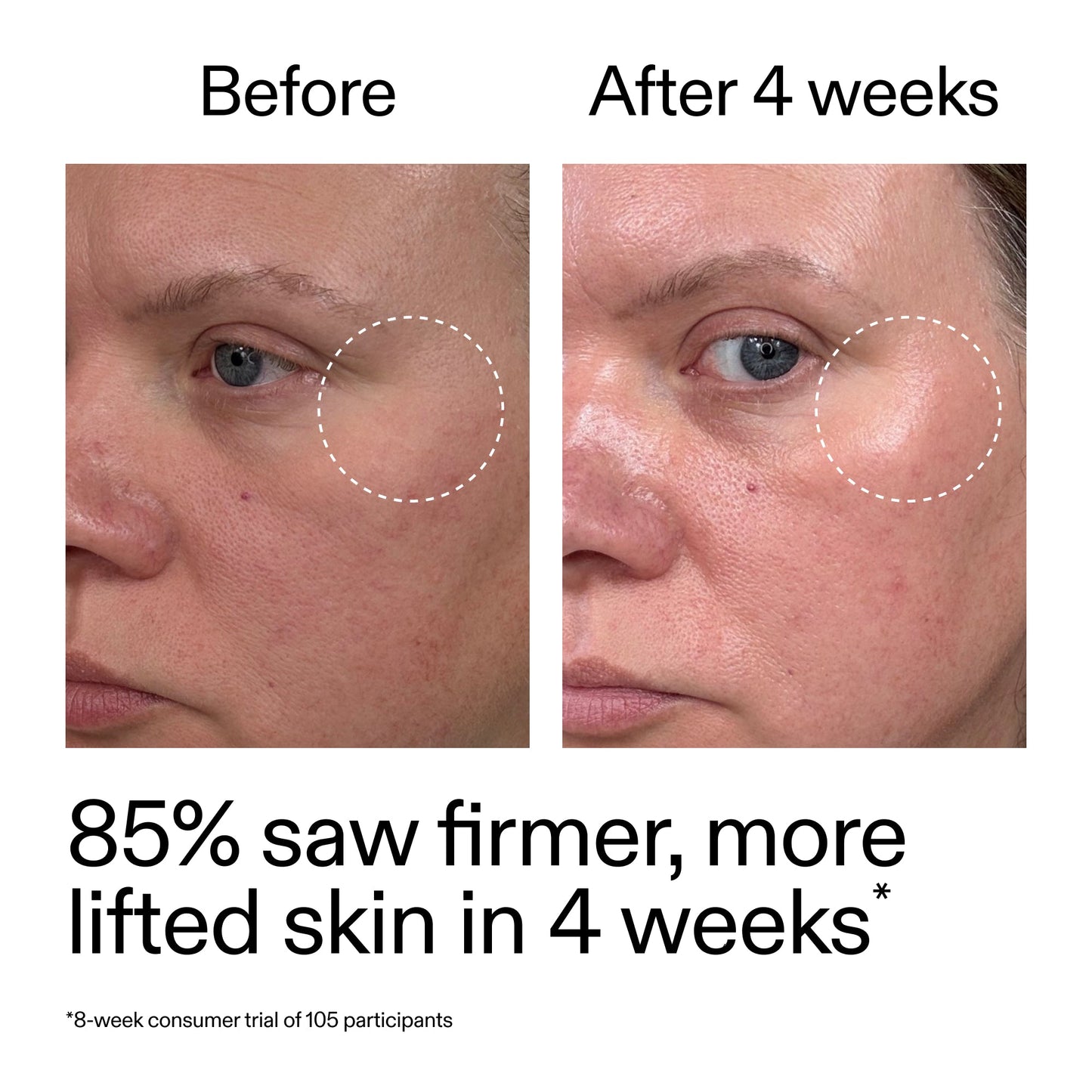 advanced-0-2-retinal-serum-duo-v4 AdvancedRetinal_BeforeAfter_Claim1_2000x2000_3a315aa8-f408-4b33-bbeb-0d9209f98404.jpg