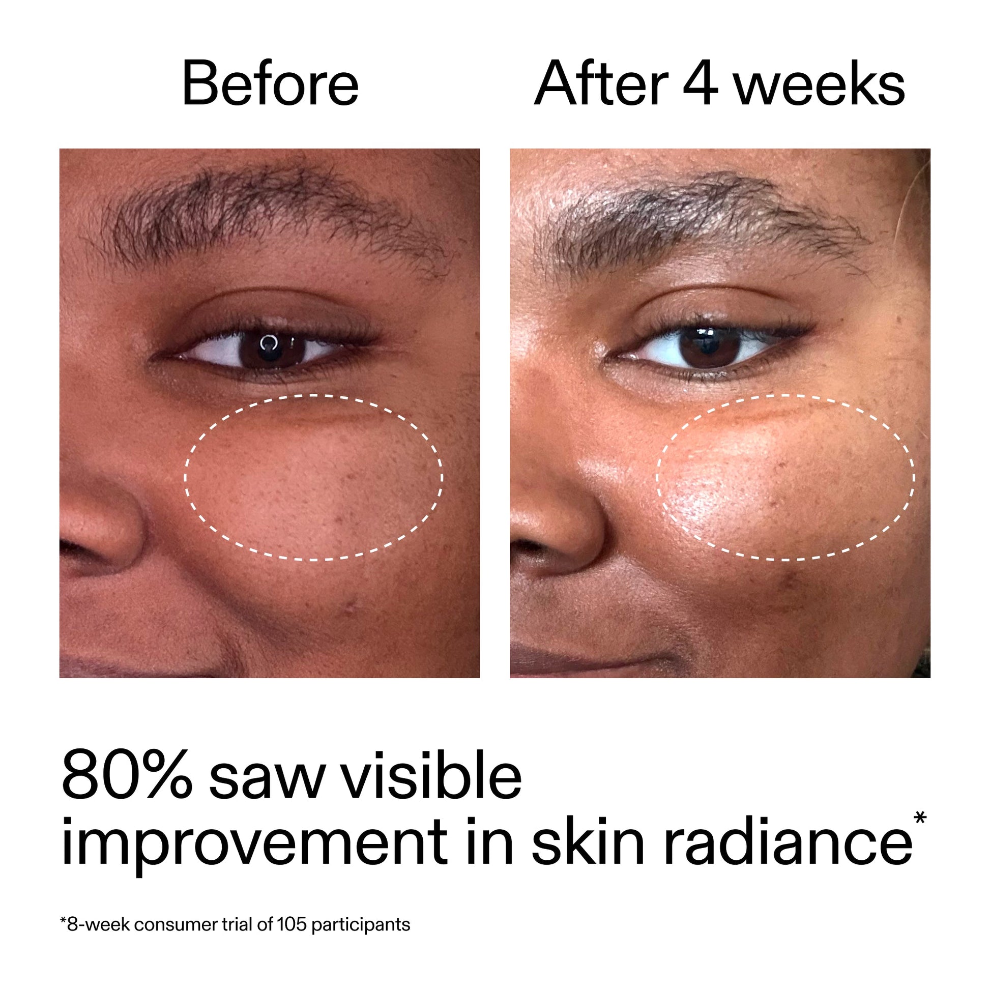 advanced-0-2-retinal-serum-k5 AdvancedRetinal_BeforeAfter_Claim2_2000x2000_39d11e3d-eda9-44ec-ab32-2903b1a368bd.jpg