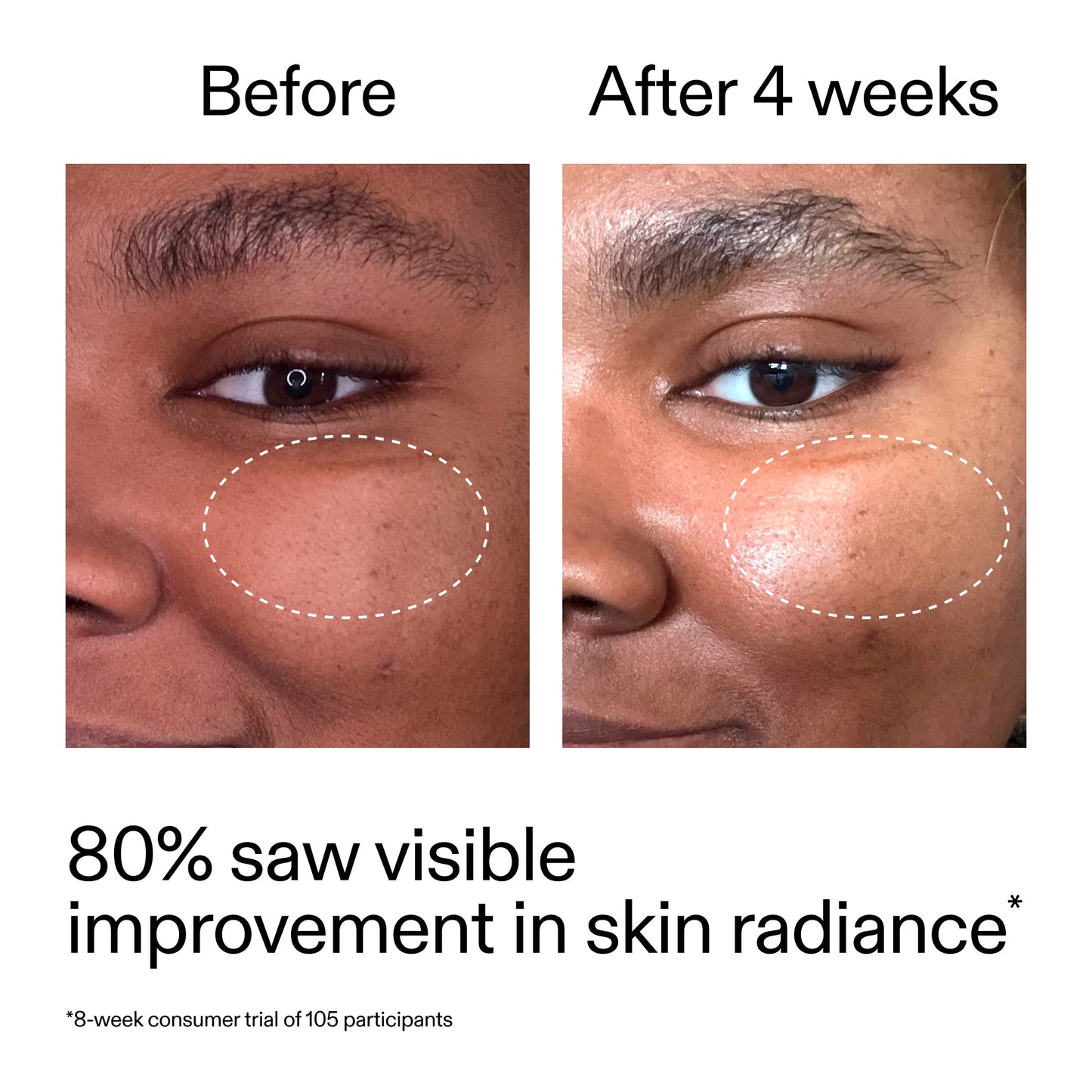 advanced-0-2-retinal-serum-duo-v4 AdvancedRetinal_BeforeAfter_Claim2_2000x2000_681b621d-8d44-4d44-9a40-89244f9b2e53.jpg
