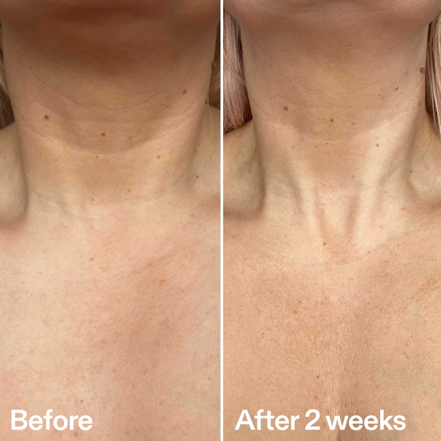 bio-active-neck-lift-stick-t0 B_A_2.jpg