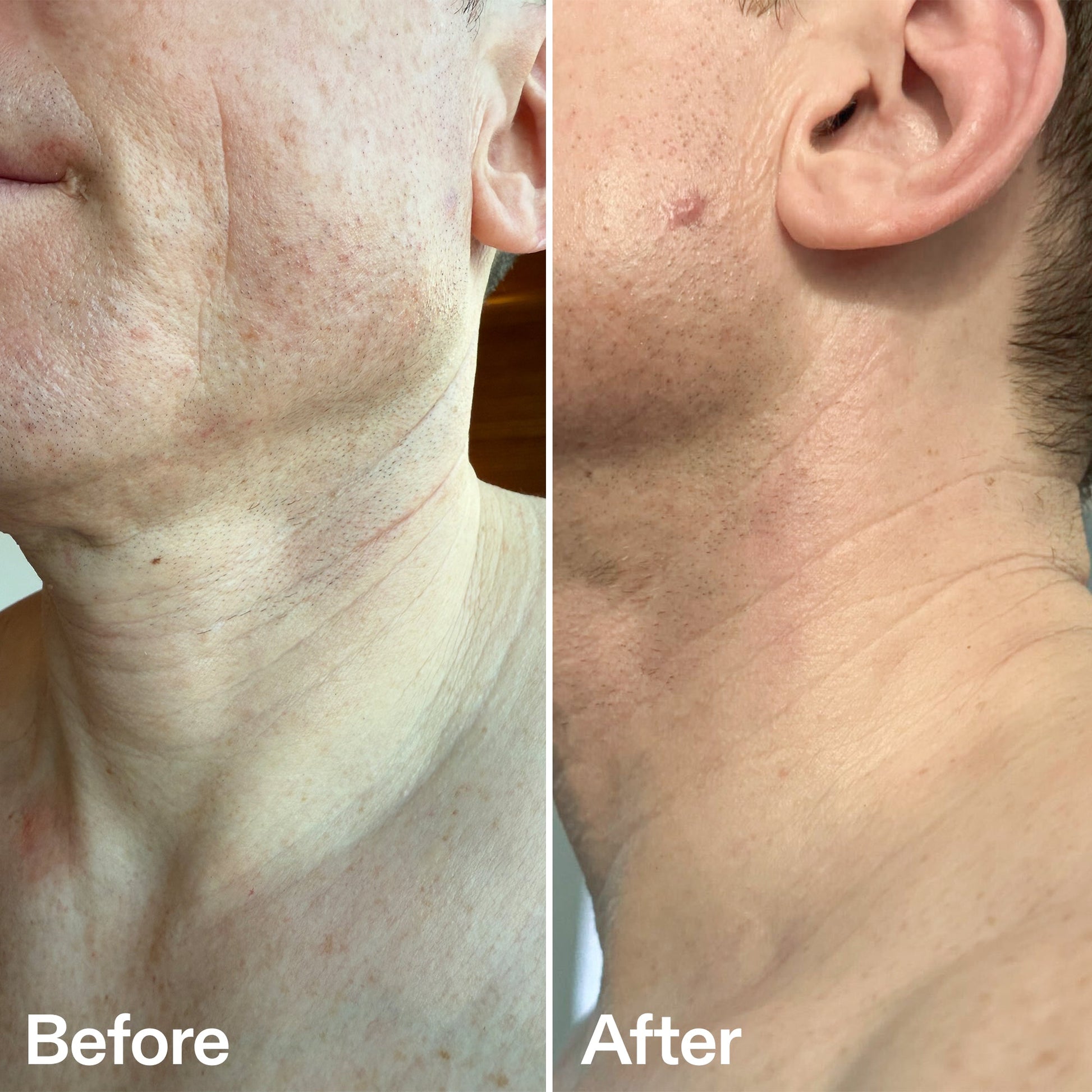 bio-active-neck-lift-stick-t0 B_A_afa2743e-b8e2-4504-92f4-e281cb6cf759.jpg