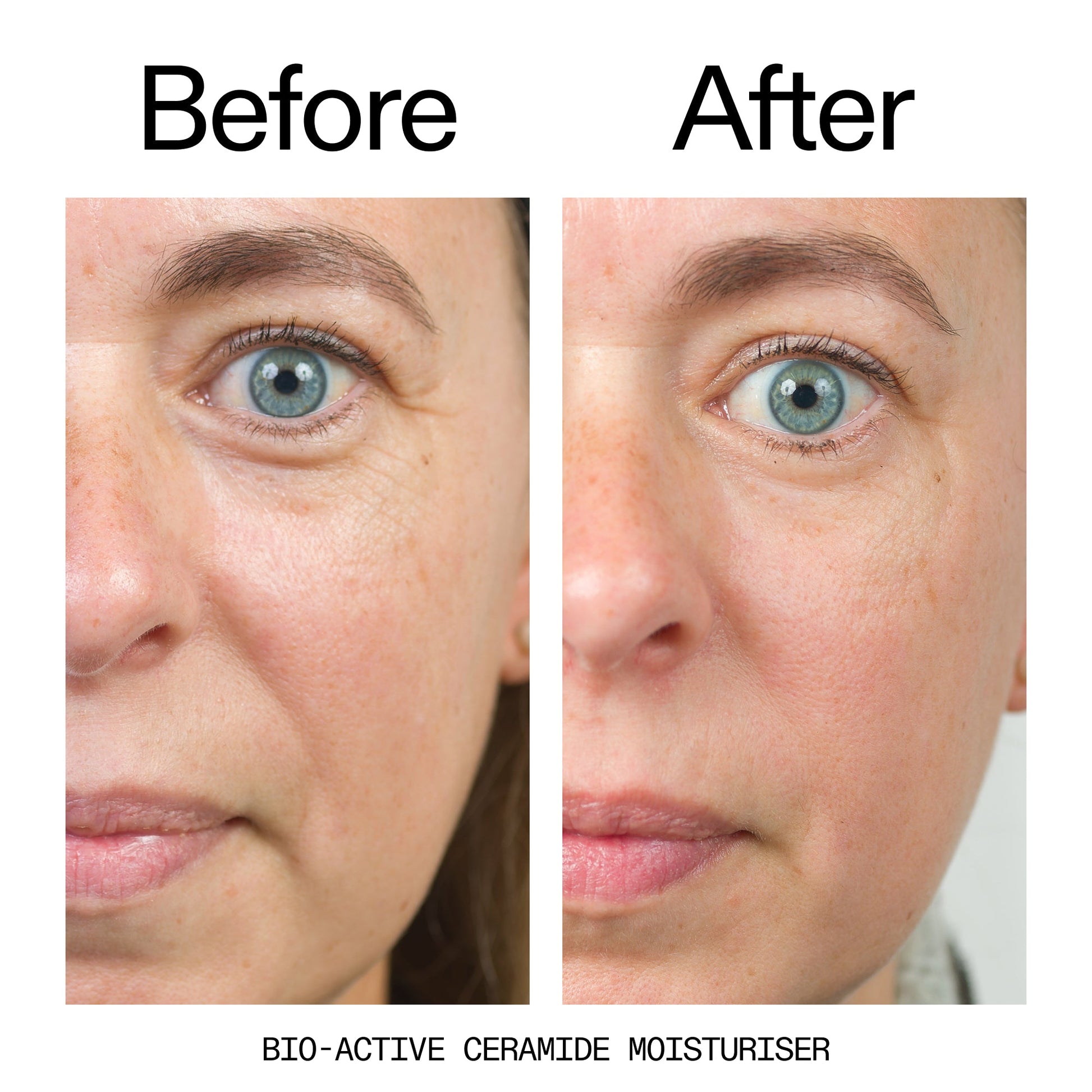 barrier-boosting-trio-f7 Bio-Active_Before_After_2000x2000_600947b4-e8c5-425a-9155-fc15bc83aa12.jpg