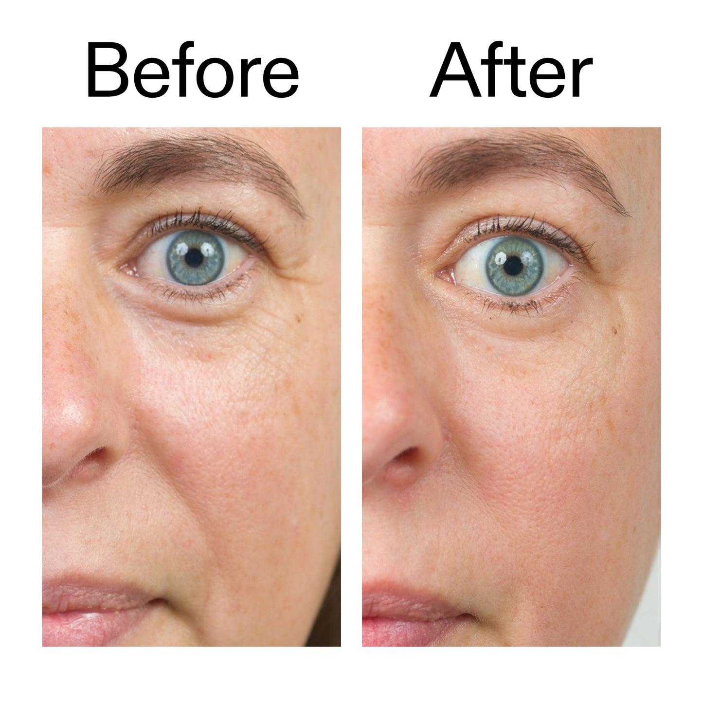 bio-active-ceramide-moisturizer-g2 Bio-Active_Before_After_2000x2000_566e5a9e-135e-417a-8242-b44e5fa35463.jpg