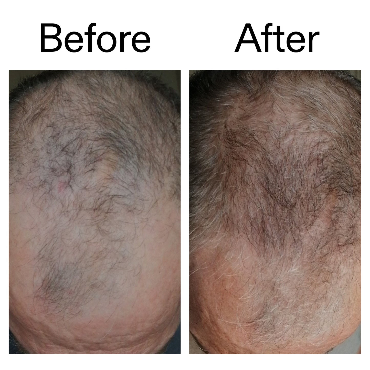 3-month-hair-growth-trio-z8 Caffeine_Scalp_Treatment_B_A_Ppage_2000_x_2000.jpg
