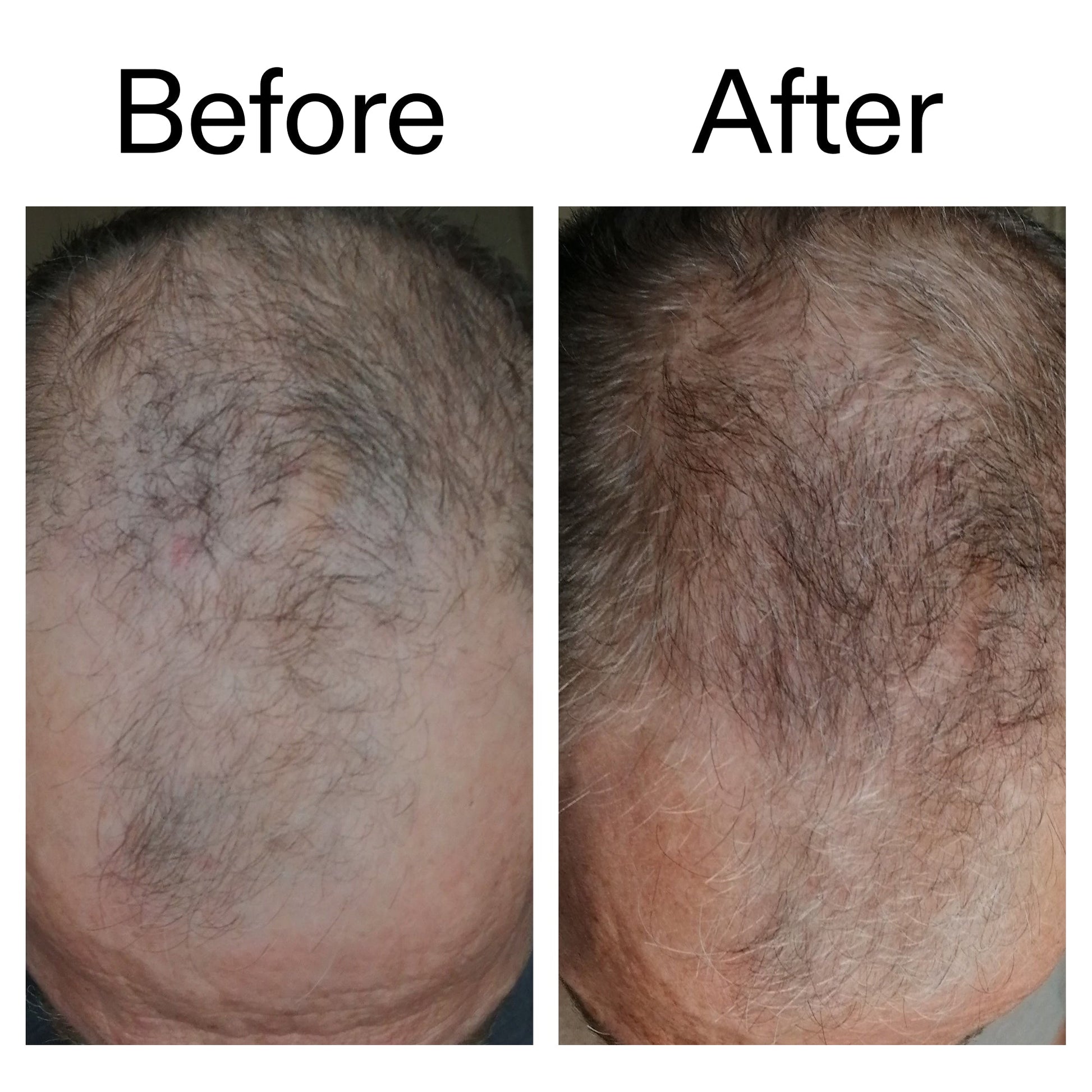 3-month-hair-growth-trio-z8 Caffeine_Scalp_Treatment_B_A_Ppage_2000_x_2000.jpg