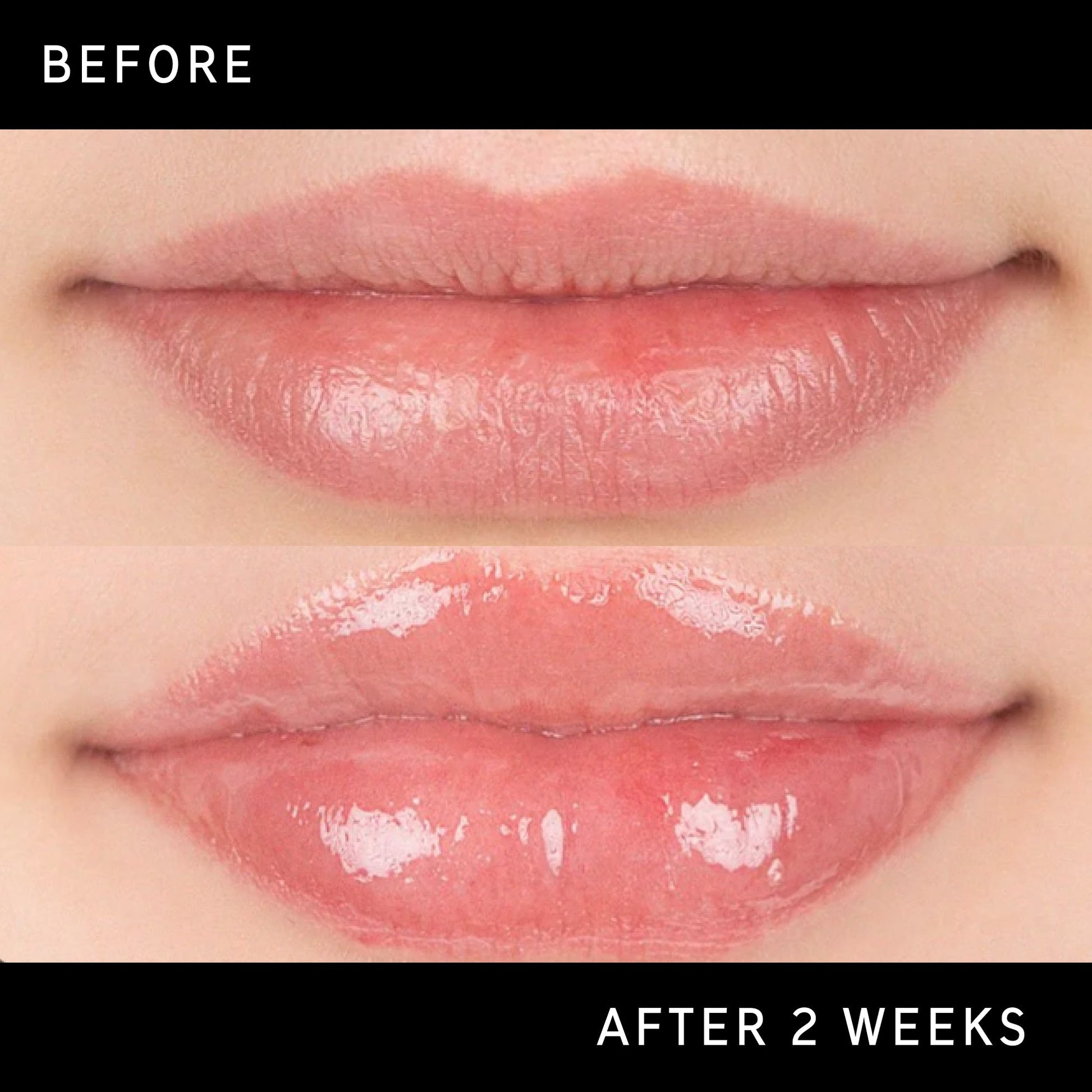 lip-plumping-duo-x8 DTC-Top15_Amends_Tripeptide-Lip_B_A.jpg