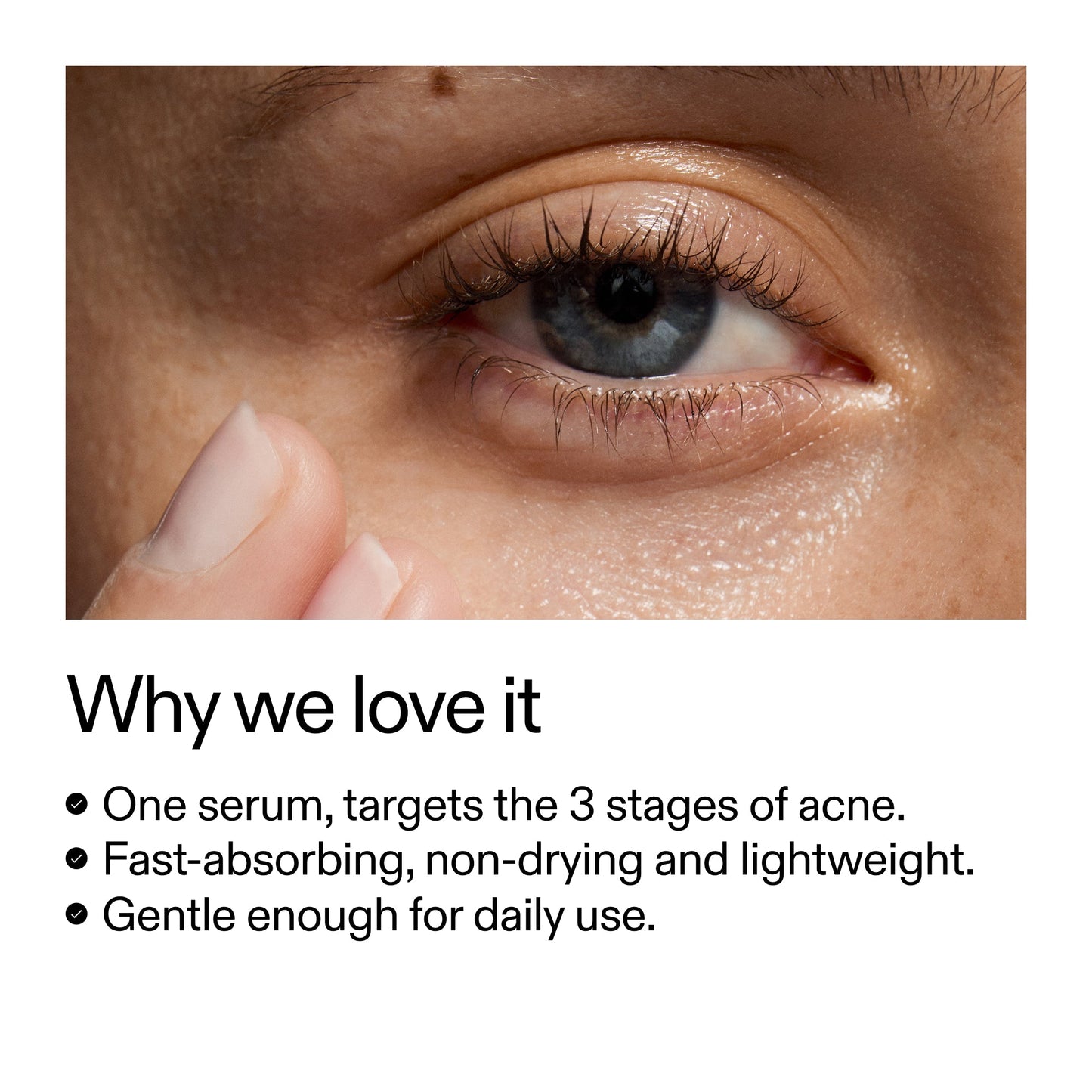 360-acne-clearing-duo-q7 Dioic_Whyweloveit_2000x2000_175aafd3-0cbe-403a-b317-a8362881bfe2.jpg