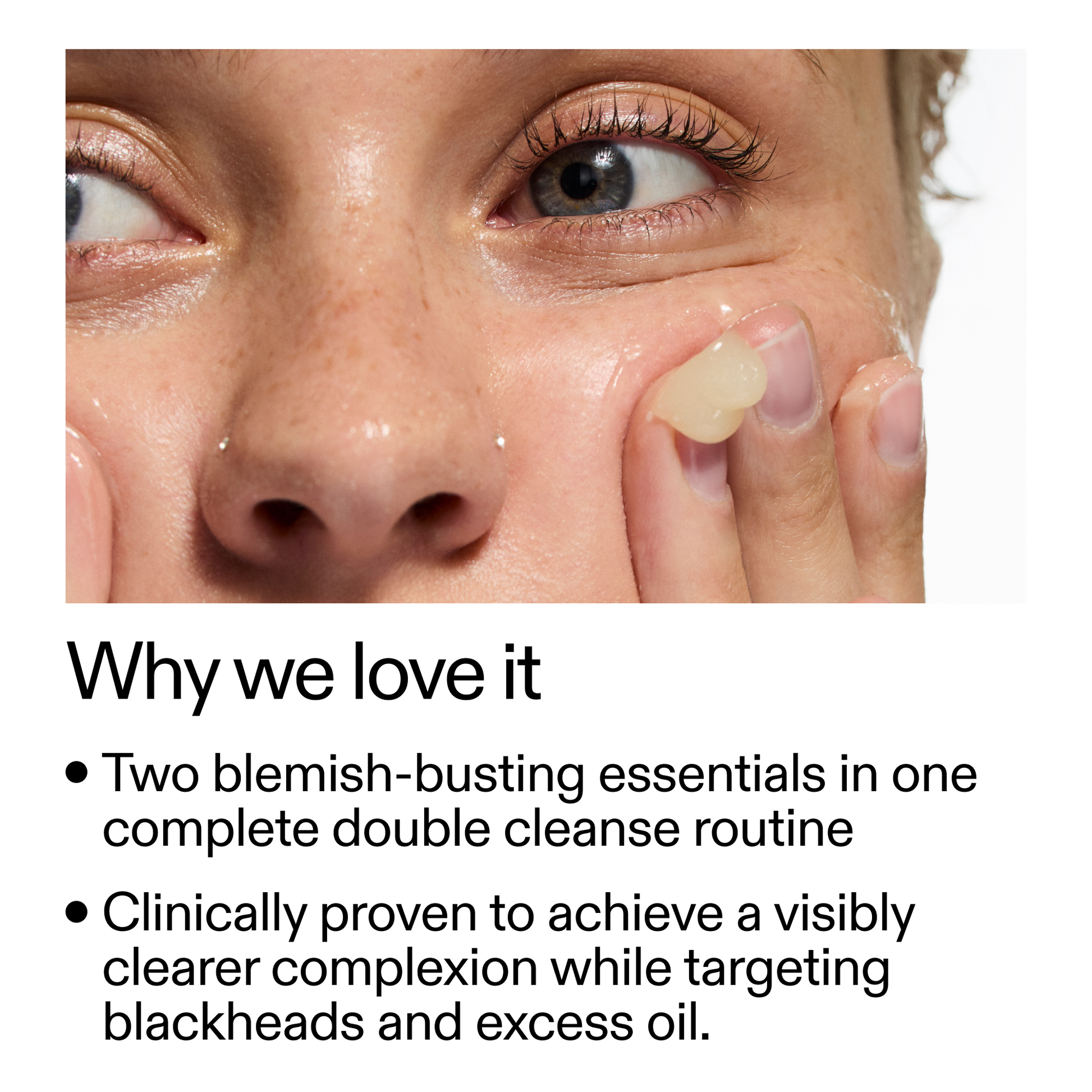 acne-double-cleanse-duo-o5 Double_Cleanse_Duo_for_Breakouts_Why_We_2000x2000_f242cb12-bb5c-487c-b203-071ccb406ec5.png