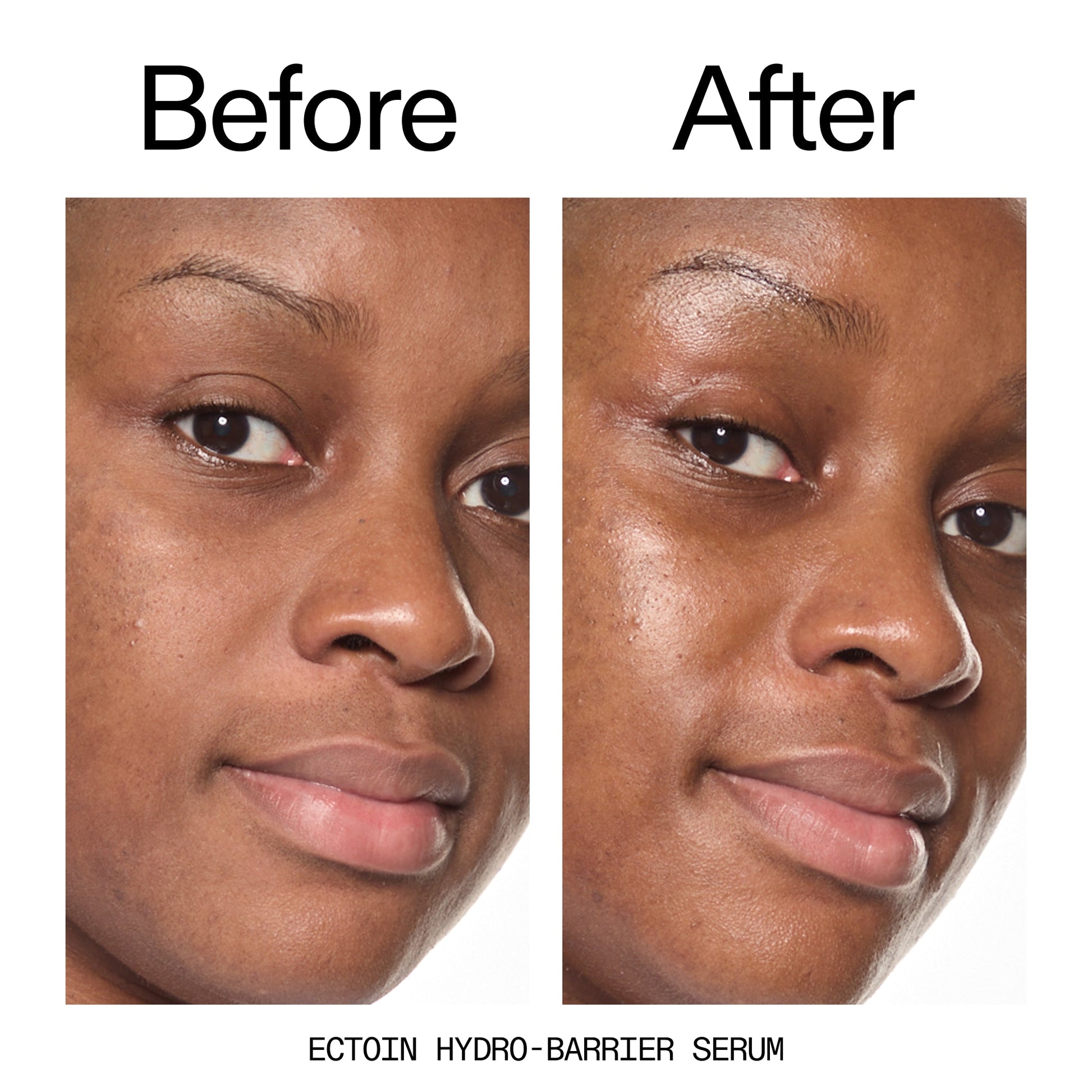 barrier-boosting-trio-f7 Ectoin_Before_After_2000x2000_ce35bc41-4da0-4b6f-adc7-29f8641f6c6c.jpg