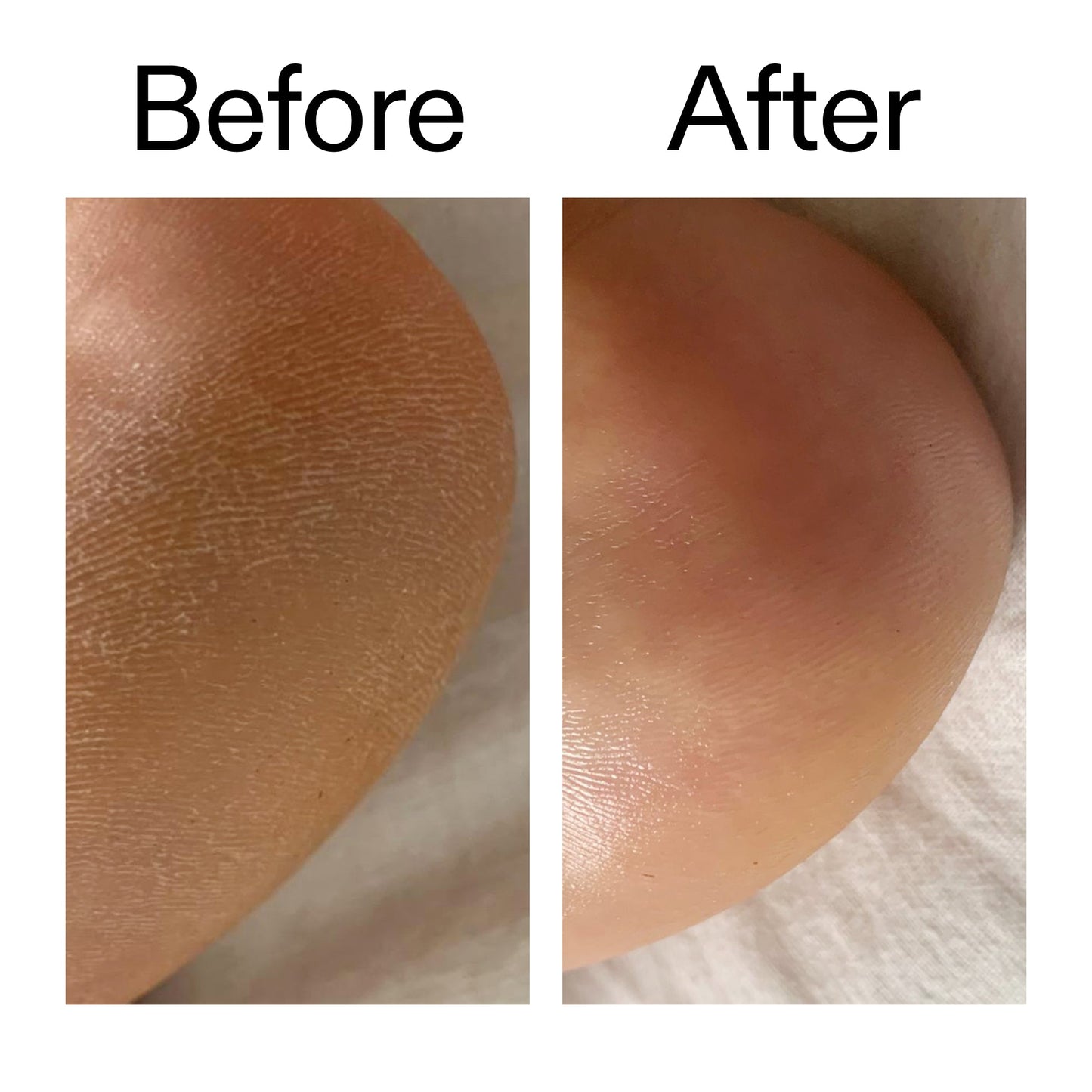 glycolic-acid-exfoliating-body-stick-q4 Glycolic_Acid_Exfoliating_Body_Stick_Before_After_V1_2000x2000_a3043625-9400-429a-a7fb-d6dbd220f722.jpg