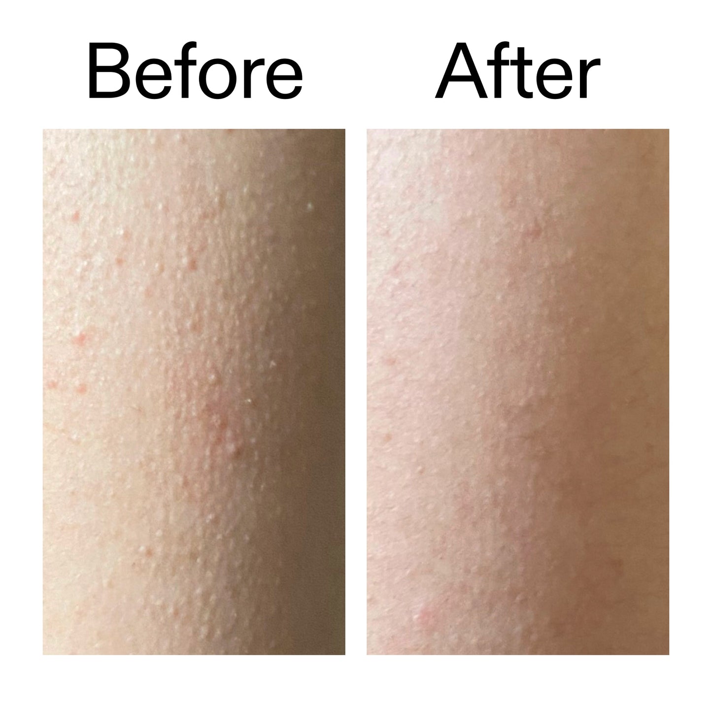 glycolic-acid-exfoliating-body-stick-q4 Glycolic_Acid_Exfoliating_Body_Stick_Before_After_V2_2000x2000_2e4ba052-94f6-4d56-82df-7bdb5b2df7ae.jpg