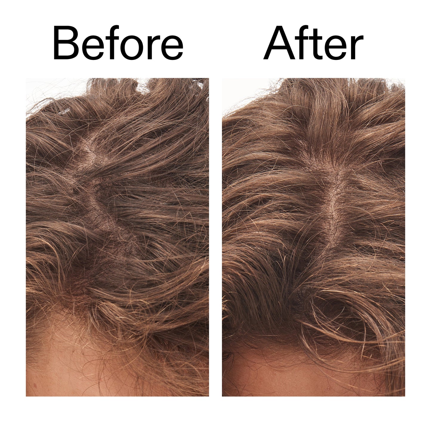 glycolic-acid-exfoliating-scalp-scrub-s9 Glycolic_Acid_Exfoliating_Scalp_Scrub_Before_After_2000x2000_b8561c87-05a1-4caa-80f7-1b6b33d750f7.jpg