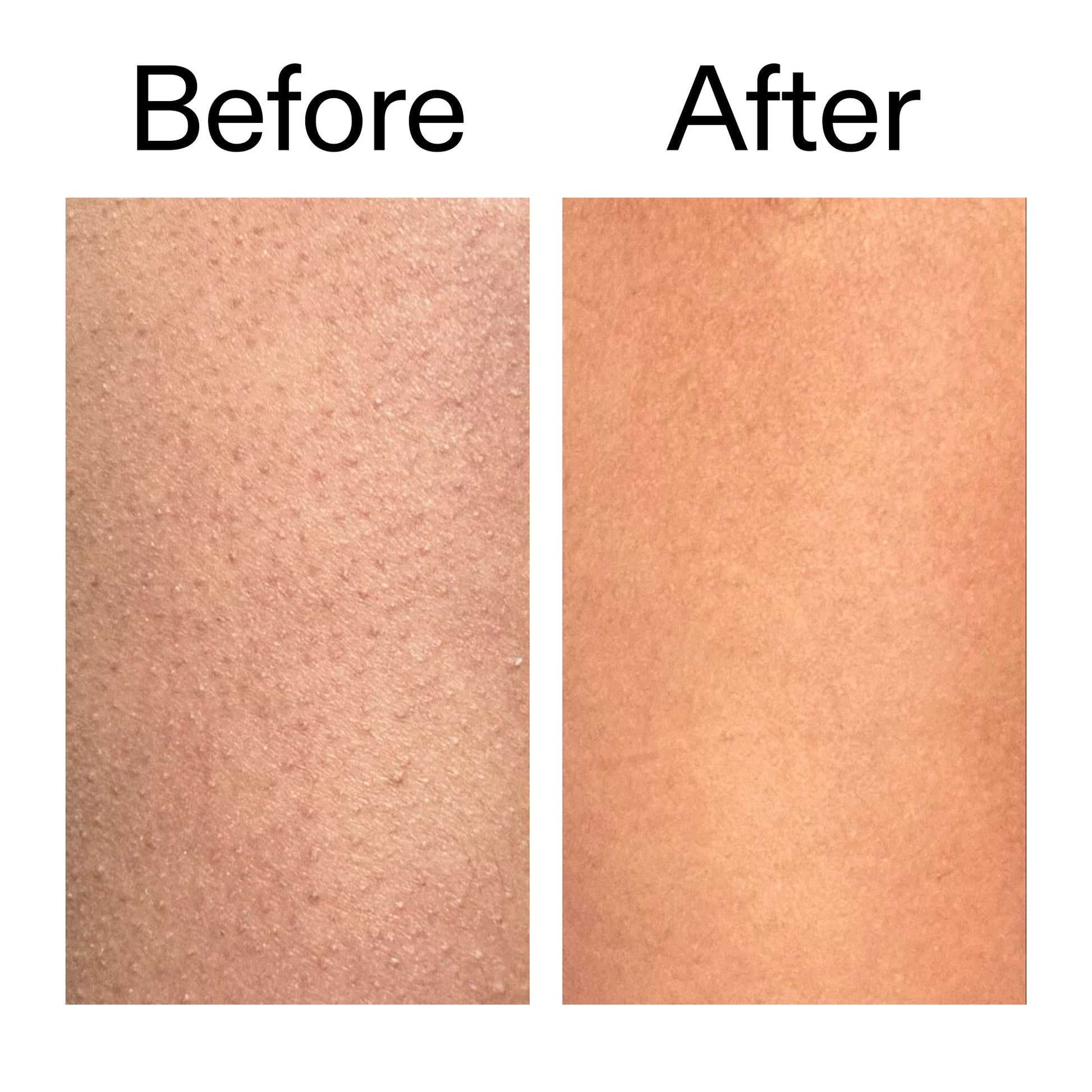 glycolic-acid-exfoliating-body-stick-m2 Glycolic_Body_Stick_B_A_2000x2000_6e6e6b4d-5bd7-43c0-aeed-4d66788e8995.jpg