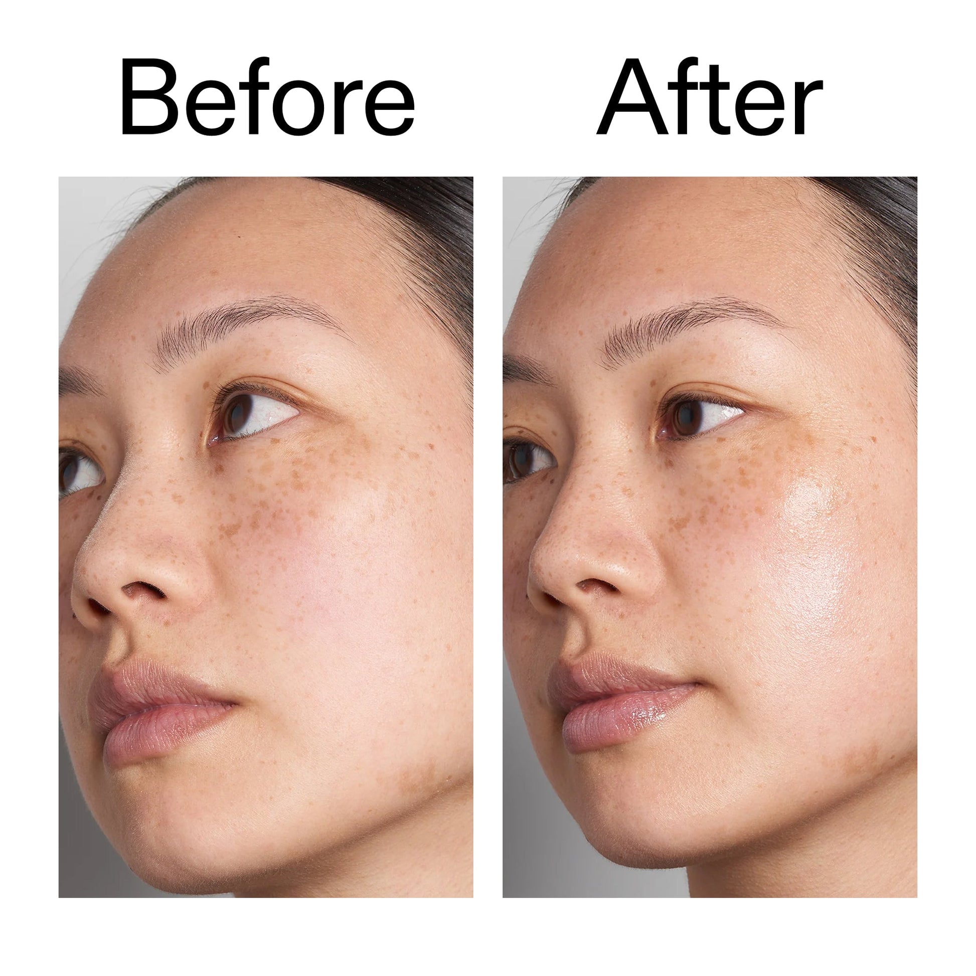 supersize-hyaluronic-acid-serum-100ml-w3 Hyaluronic_Acid_Before_After_2000x2000_d7983956-8aa2-4ea3-8255-c63e8d4f892e.jpg