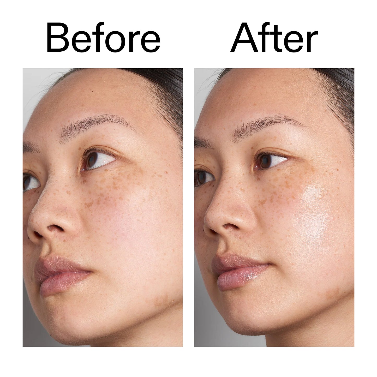 hyaluronic-acid-serum-60ml-d8 Hyaluronic_Acid_Before_After_2000x2000_d7983956-8aa2-4ea3-8255-c63e8d4f892e.jpg