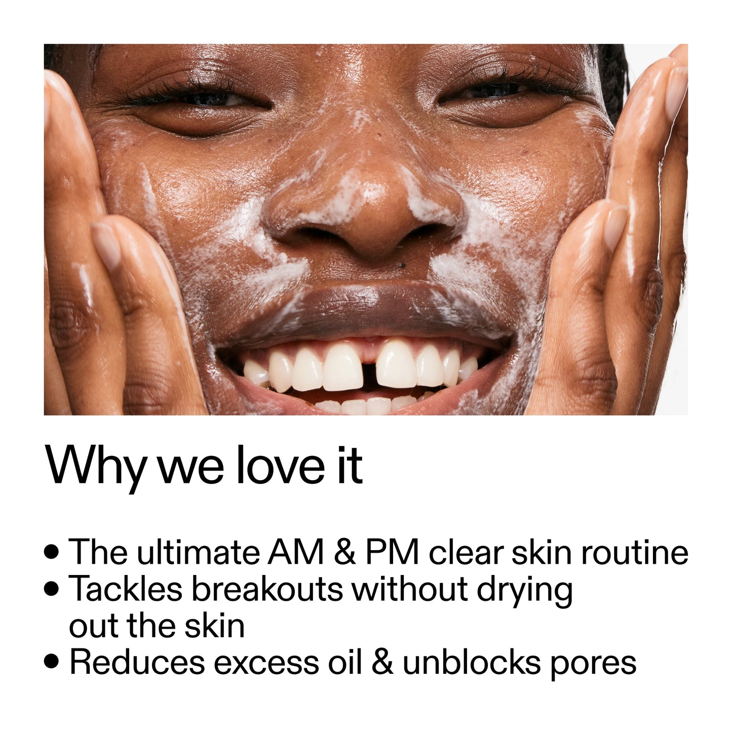 intro-routine-for-acne-h5 Intro_Routine_for_Acne_Why_we_love_it_2000x2000_42499e10-4629-4a0e-a627-7e215f4da6bc.jpg
