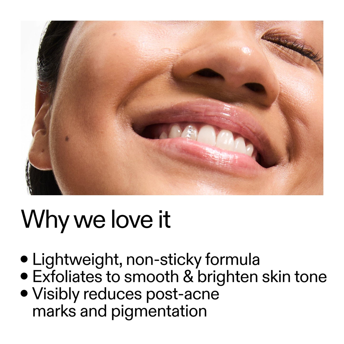 mandelic-acid-treatment-q3 Mandelic_Acid_Treatment_Why_we_love_it_2000x2000_6dfe29a9-2a79-464f-a5e8-e5ac37d93388.jpg
