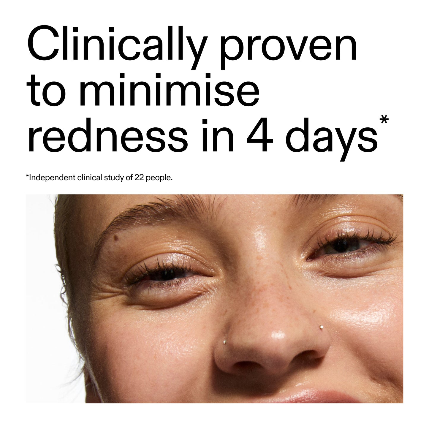 10-azelaic-acid-serum-for-redness-relief-p9 Oat_Cleansing_Balm_Claim_2000x2000_52a841dc-353c-4f2c-8646-3aadb604507d.jpg