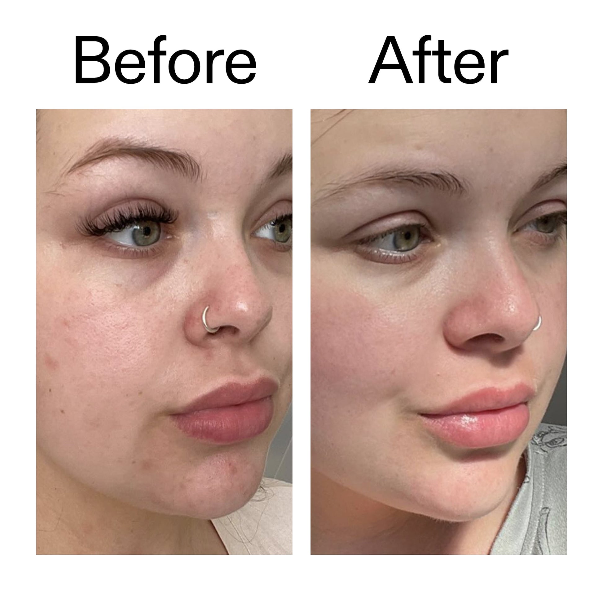 supersize-omega-water-cream-100ml-v2 Omega50_Before_After_2000x2000_46483ed8-3f9d-487f-9a0c-9df79830bd65.jpg