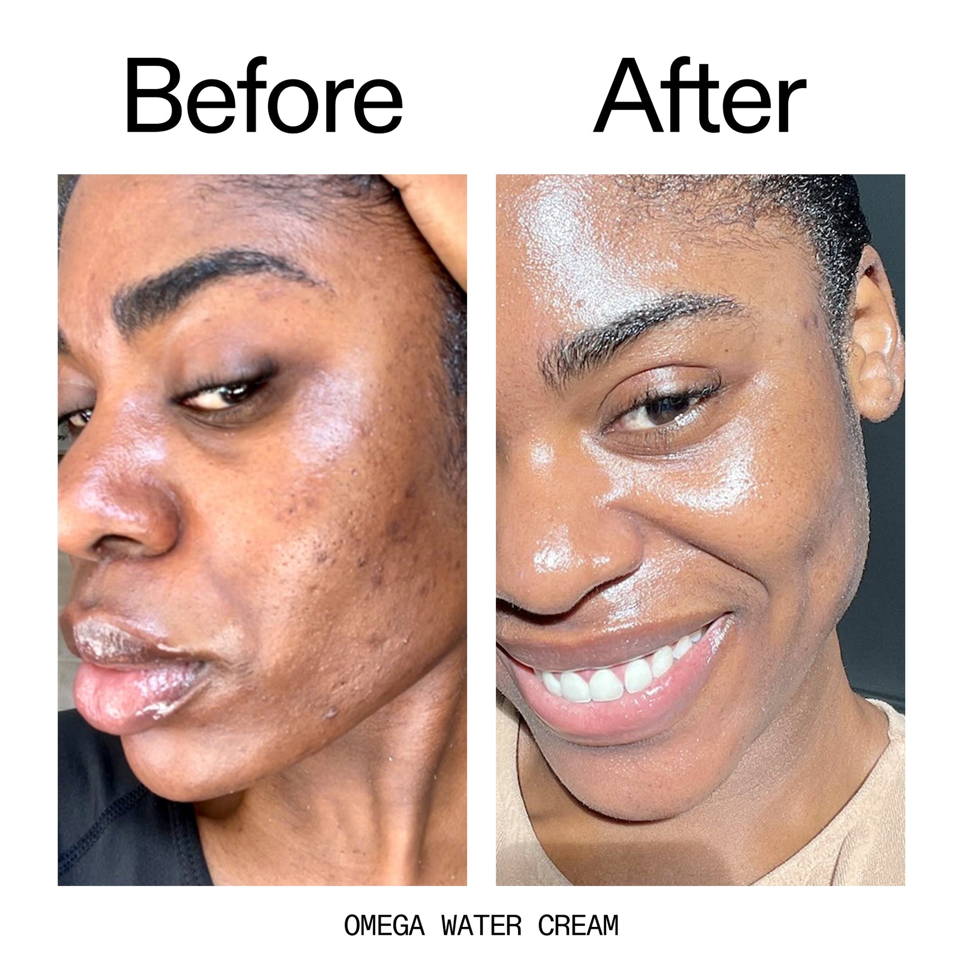 hydrating-cleanser-and-moisturizer-duo-h3 Omega_Water_Cream_Before_After_2000x2000_8e88278b-8c8d-48dc-ac77-4e98ebbd1b77.jpg