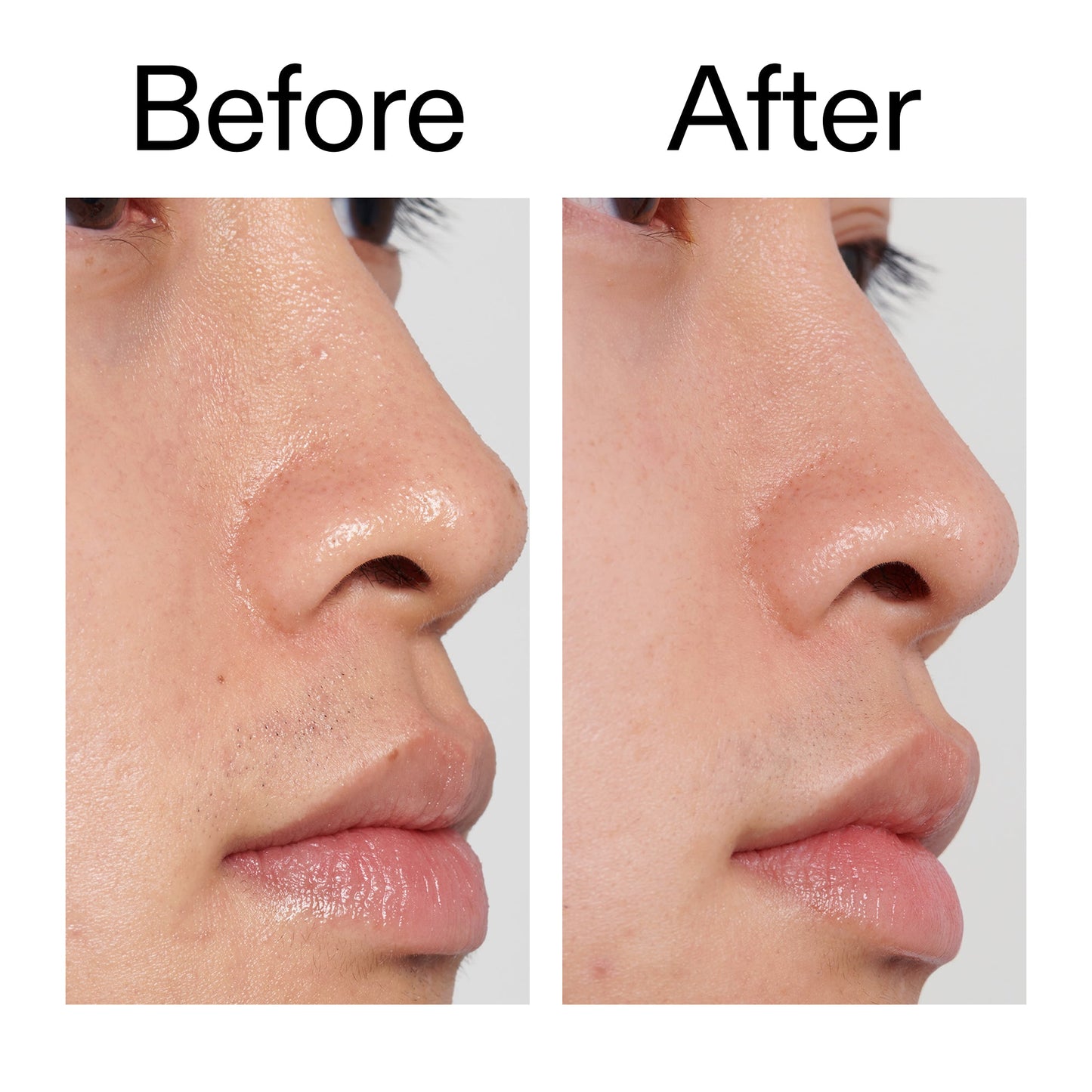 pha-toner-j4 PHA_Toner_Before_After_2000x2000_e3c10172-0150-4342-8b95-57417eaff50d.jpg