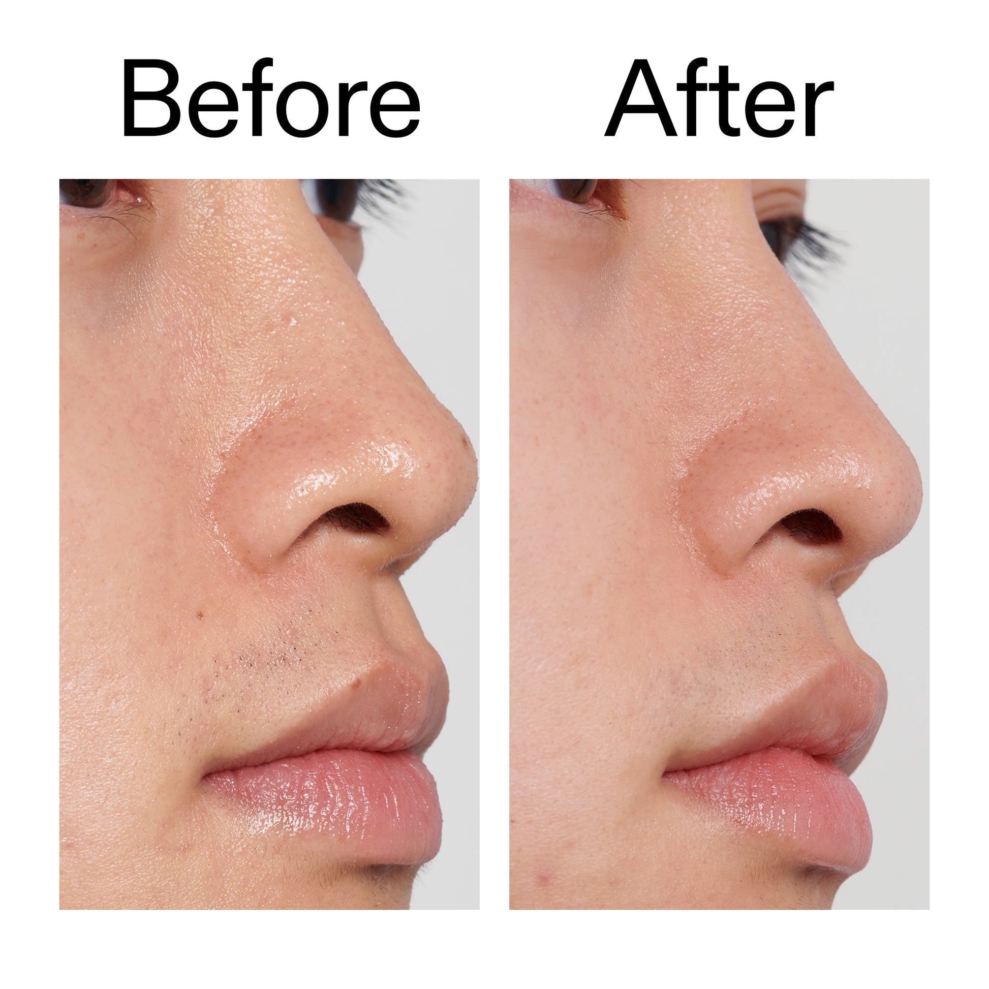 pha-toner-j4 PHA_Toner_Before_After_2000x2000_e3c10172-0150-4342-8b95-57417eaff50d.jpg