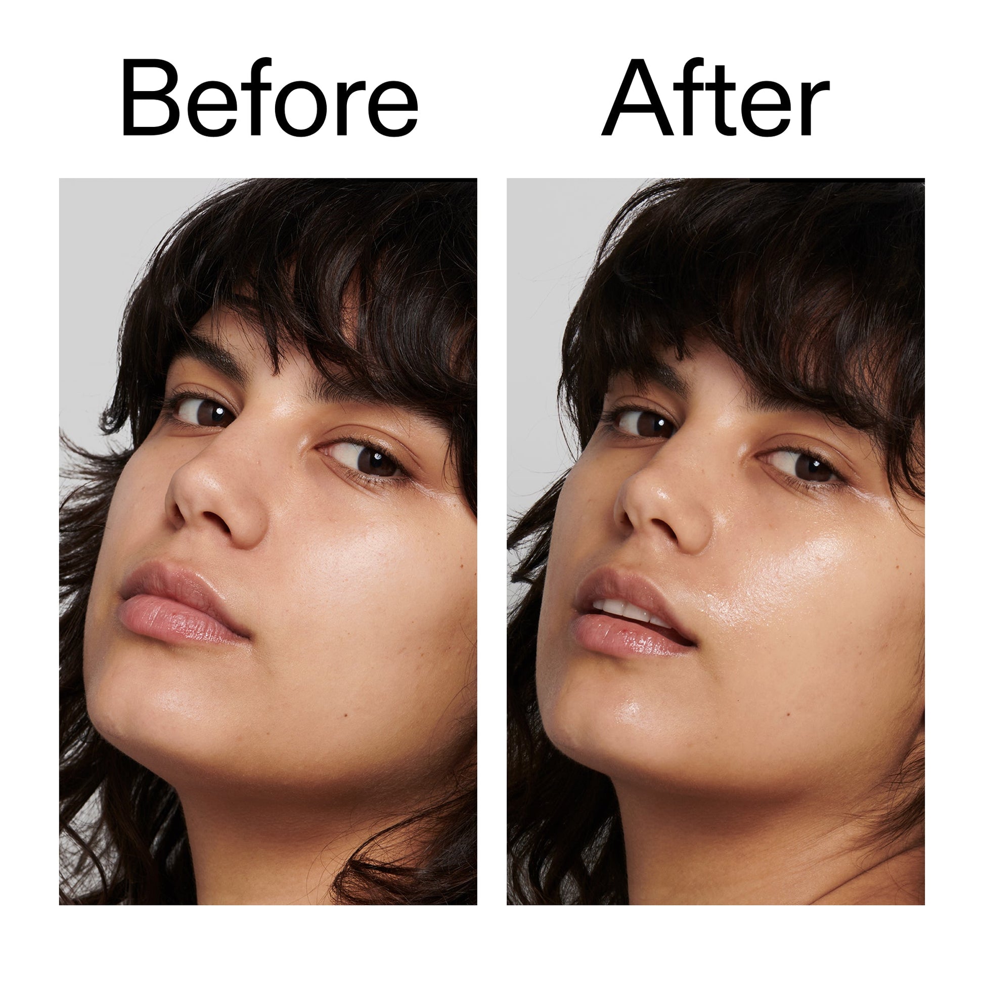 polyglutamic-acid-serum-r7 Polyglutamic_Acid_Serum_Before_After_2000x2000_dc0e1f71-d72b-4358-9c3a-ae43ead715d6.jpg