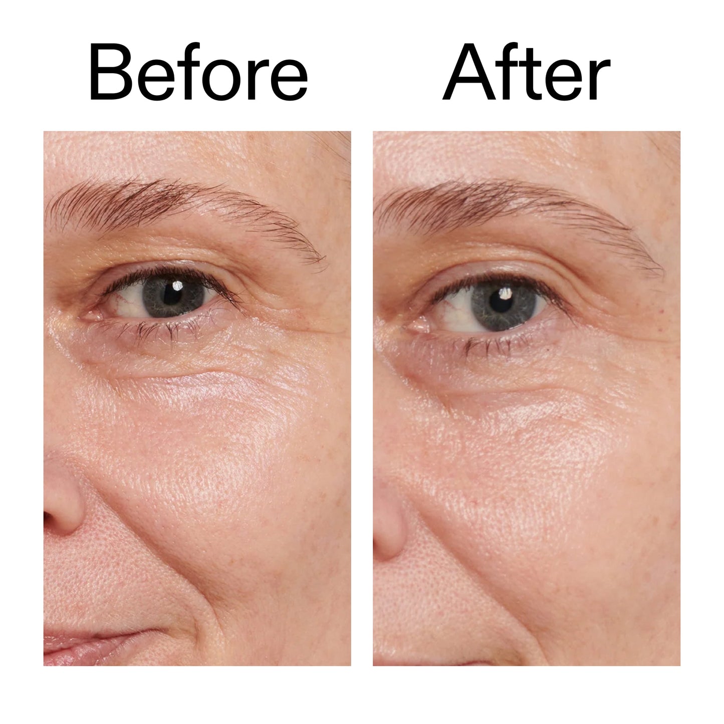 retinol-eye-cream-w1 Retinol_Eye_Cream_Before_After_2000x2000_ac03a80c-109e-4572-a95a-91dc109b4d27.jpg