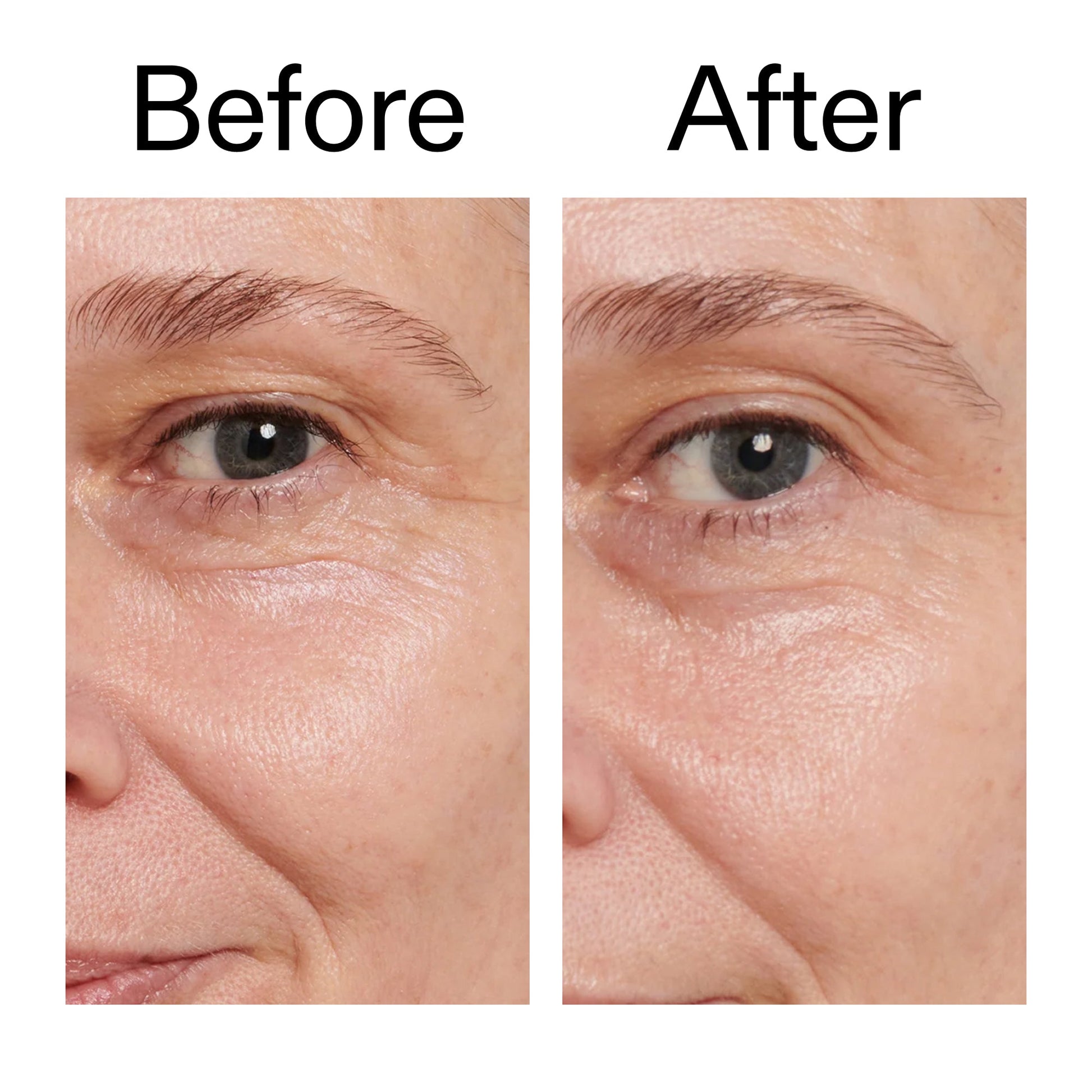 retinol-eye-cream-w1 Retinol_Eye_Cream_Before_After_2000x2000_ac03a80c-109e-4572-a95a-91dc109b4d27.jpg