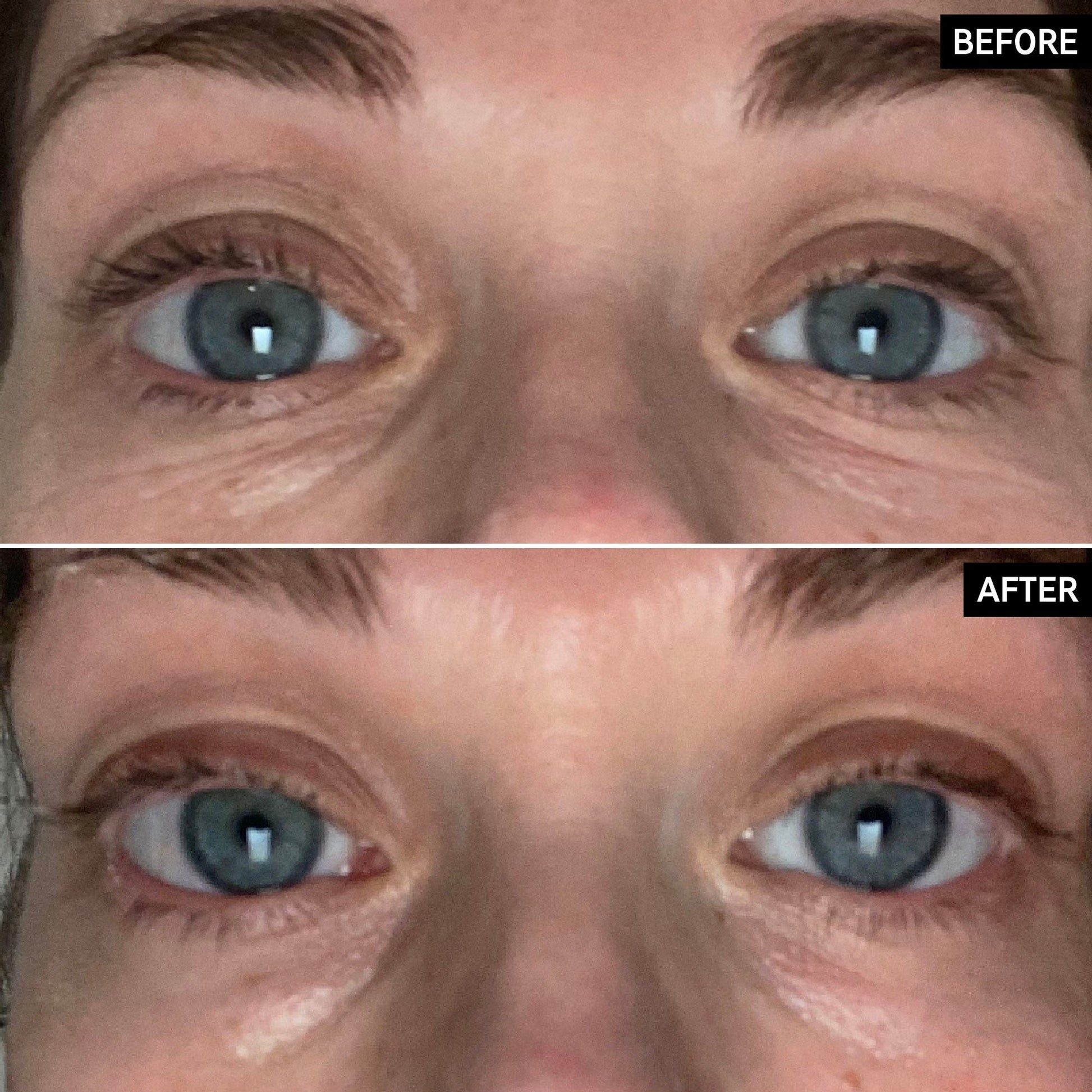 retinol-eye-cream-w1 SITE-UGCBAsApril_Nicole_B_A_PPage_2000x2000_1.jpg