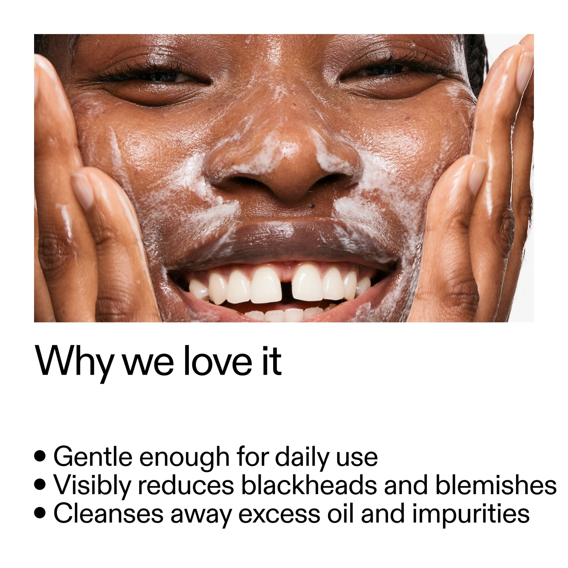 salicylic-acid-cleanser-duo-i5 Salicylic_Acid_Cleanser_-_300mlWhy_we_love_it_2000x2000_87dc92a9-2559-4309-98cd-4e570f1be735.jpg