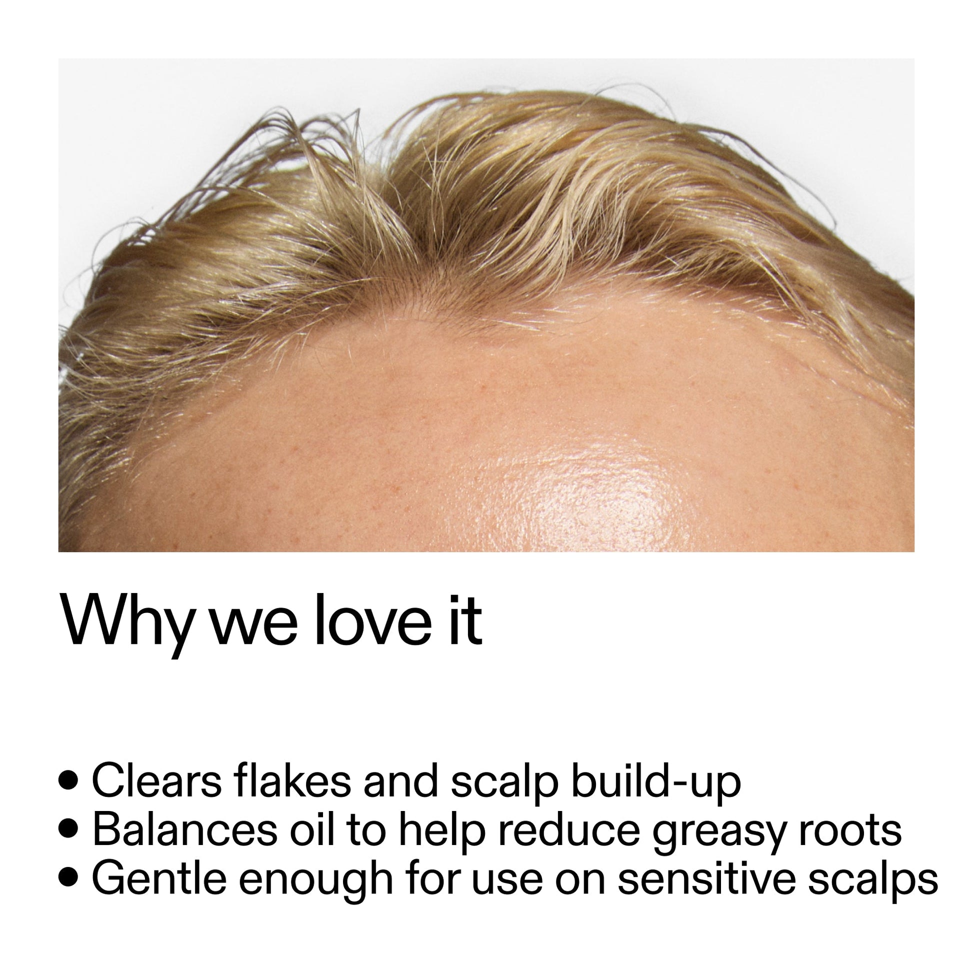 salicylic-acid-exfoliating-scalp-treatment-m9 Salicylic_Acid_Exfoliating_Scalp_Treatment_Why_we_love_it_2000x2000_44b6bd6d-9ec4-4b23-9dc4-bc3fd6f28e14.jpg