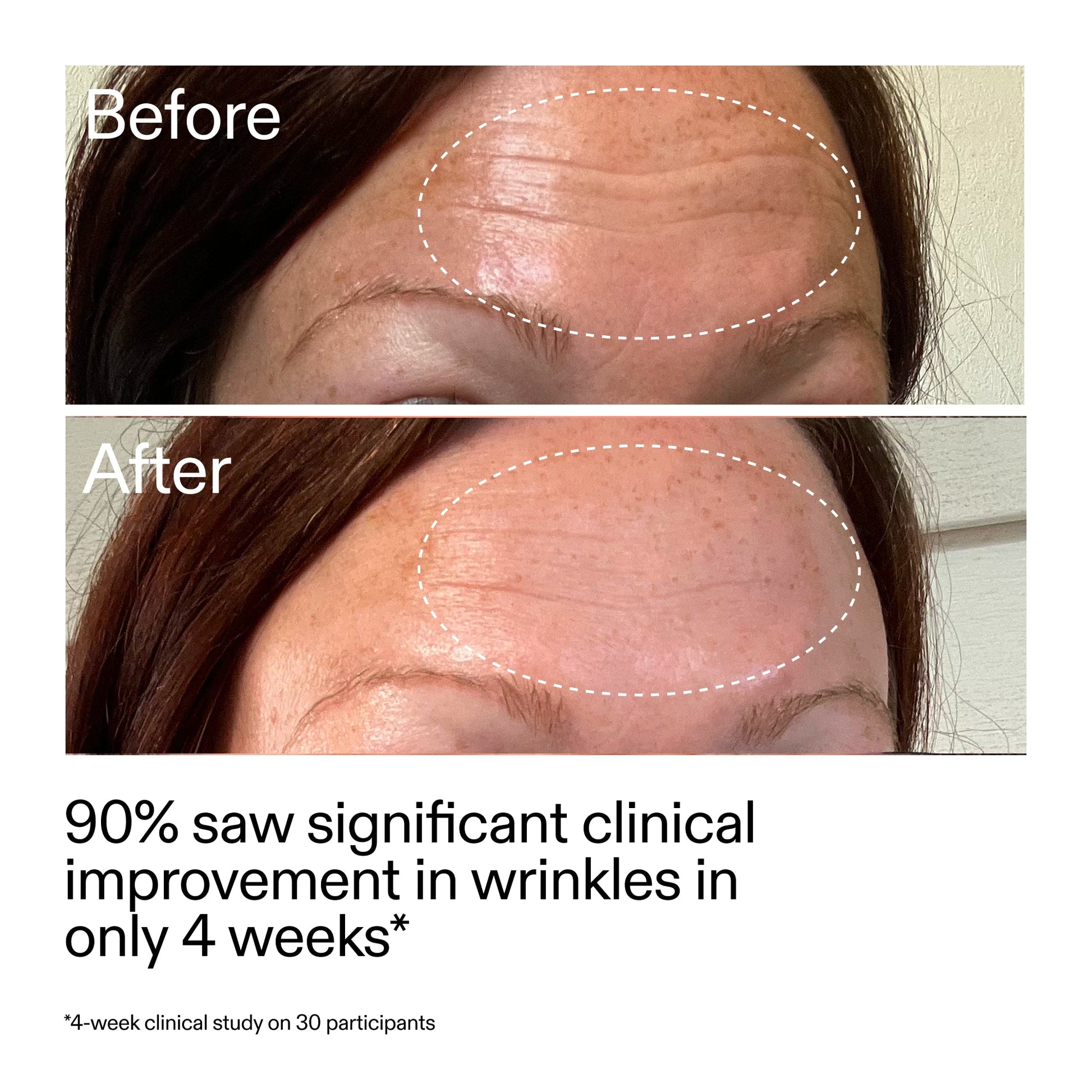 starter-retinol-serum-e2 StarterRetinol_BeforeAfter_Claim1_2000x2000_a09b50b6-4688-4527-abae-21bd142b89b7.jpg