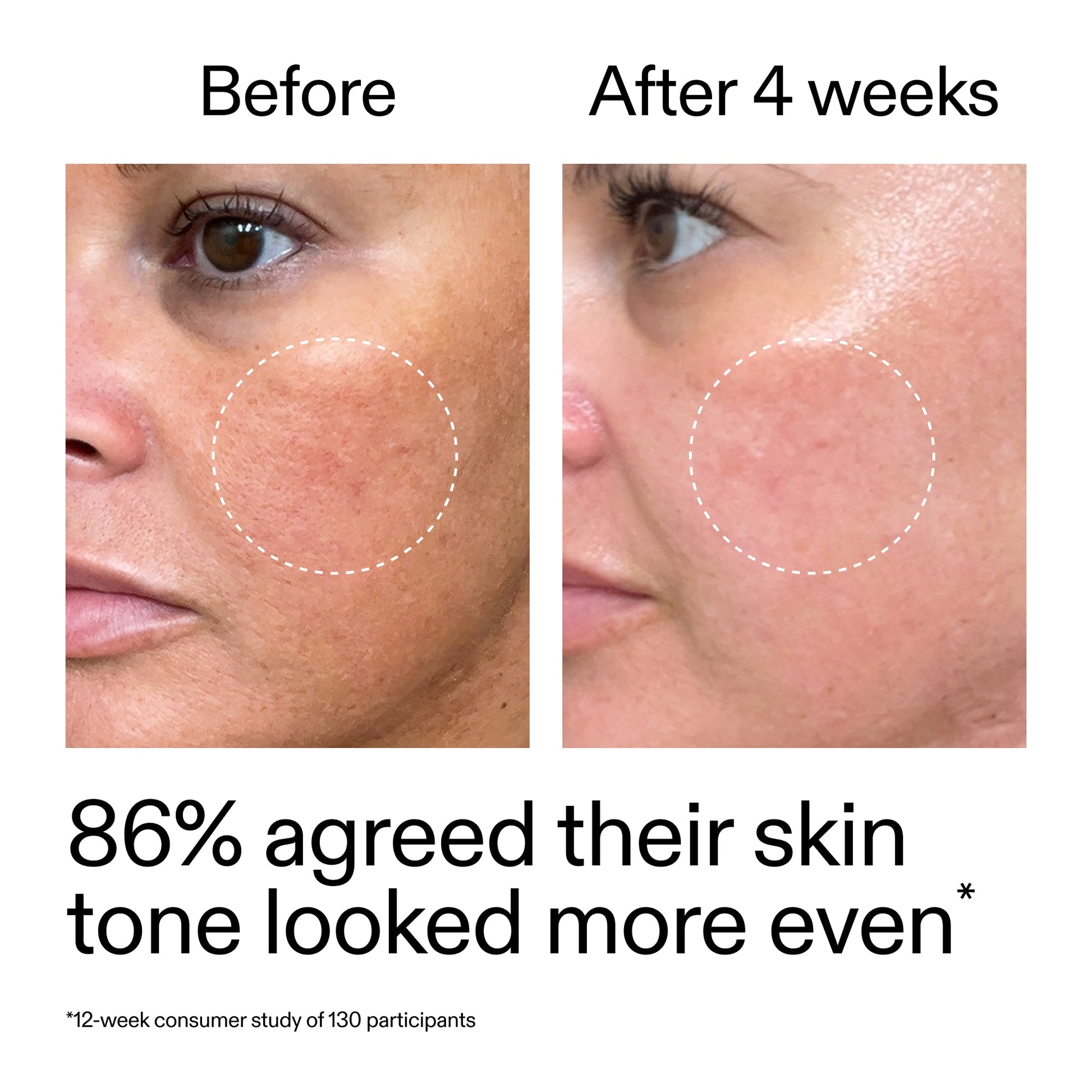 starter-retinol-serum-e2 StarterRetinol_BeforeAfter_Claim2_2000x2000_f5c9ecc0-8d76-429d-bef5-c3a61bcf5c09.jpg