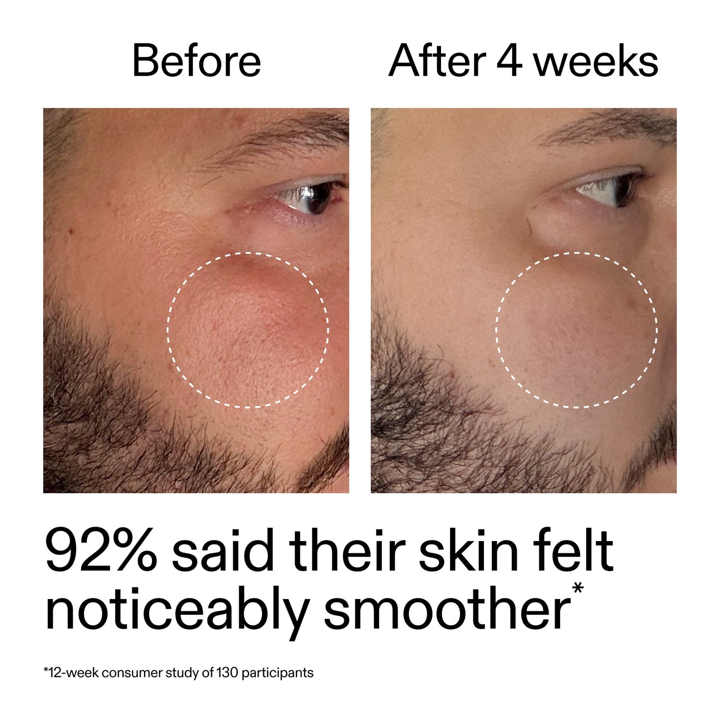 starter-retinol-serum-e2 StarterRetinol_BeforeAfter_Claim3_2000x2000_6ceab106-e0ee-4ed4-ba62-41bc39538038.jpg