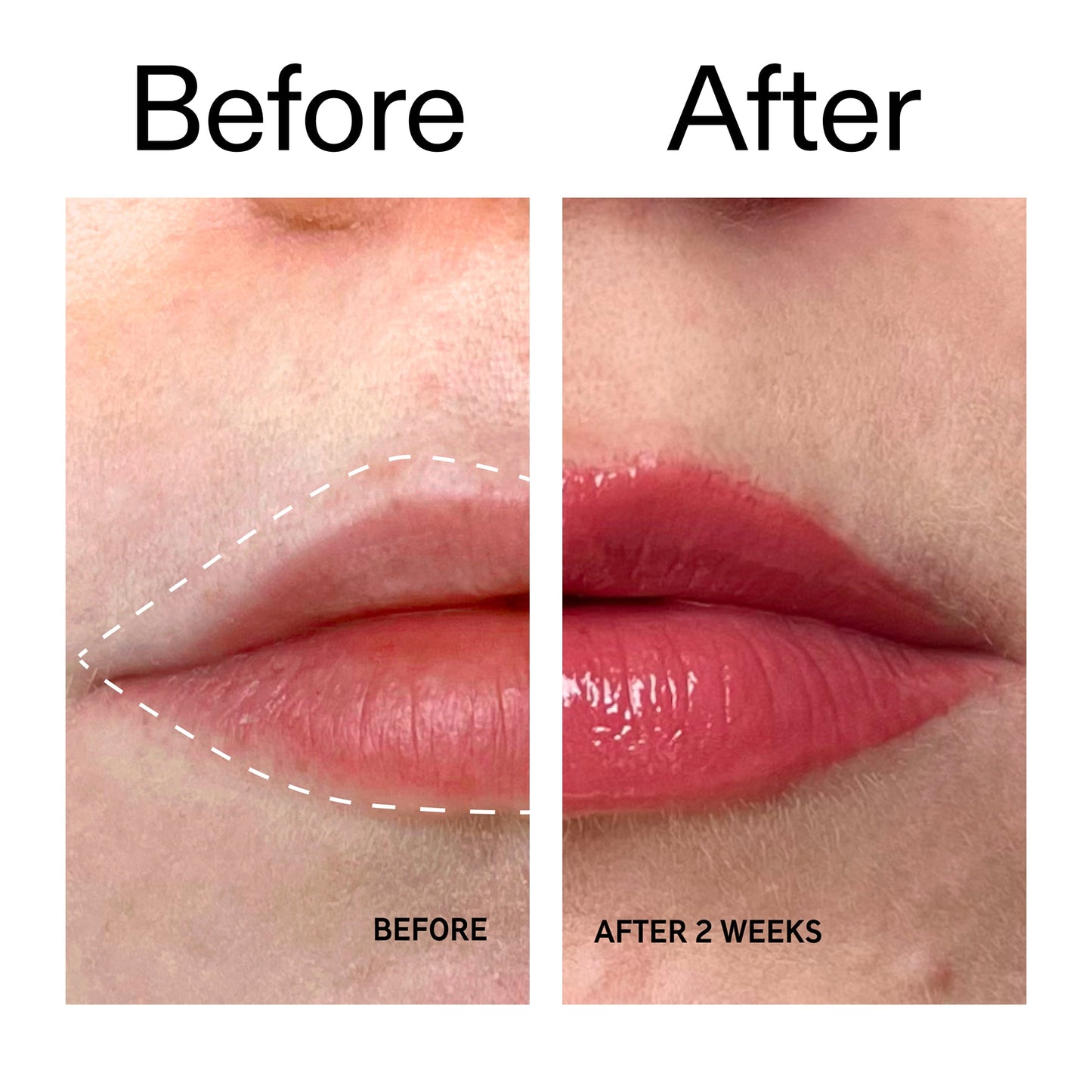 tripeptide-plumping-berry-lip-balm-p9 Tripeptide_Plumping_Lip_Balm_-_Berry_Before_After_2000x2000_9474bbd8-43ca-4b0e-b0e7-dfab70b91927.jpg