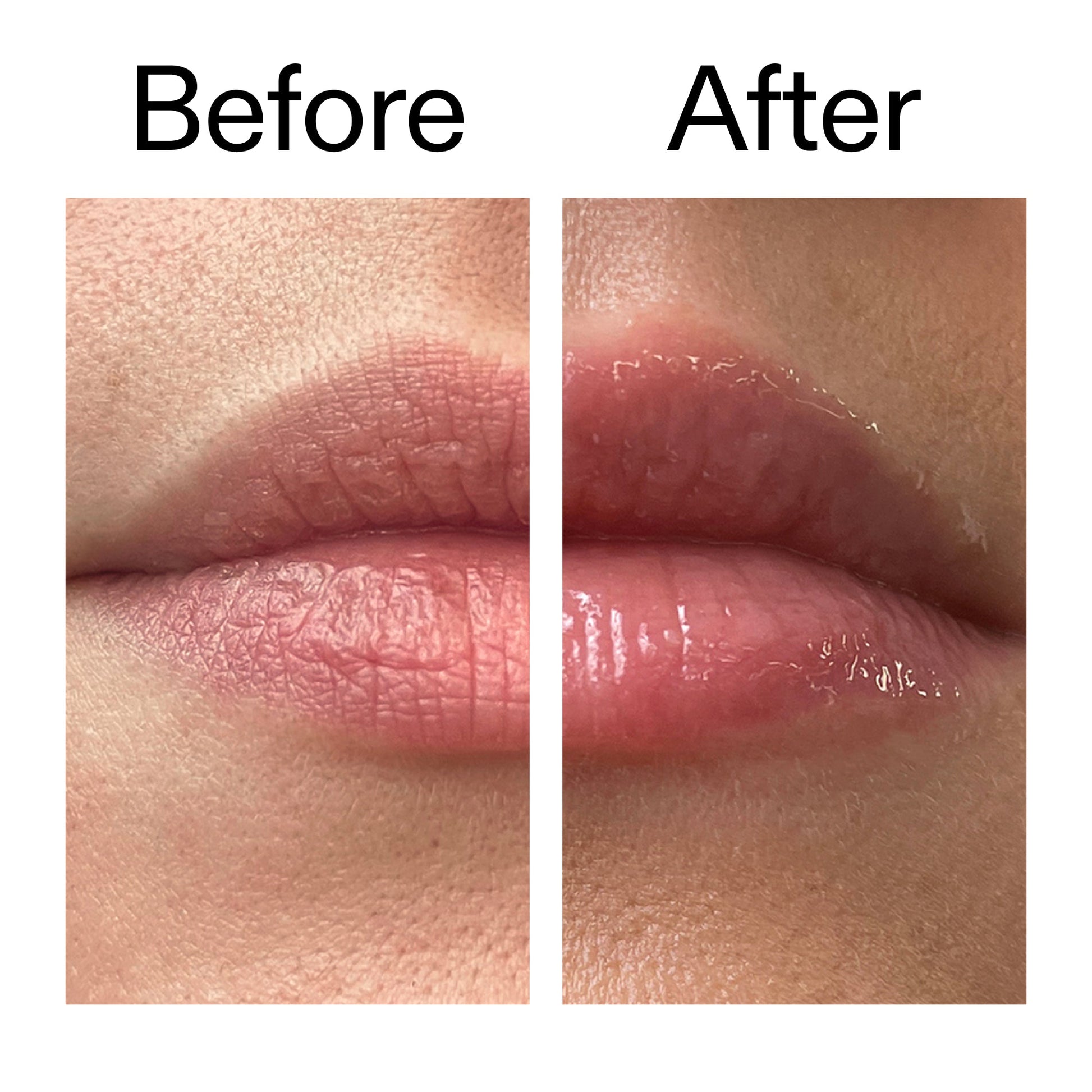 tripeptide-plumping-lip-balm-d3 Tripeptide_Plumping_Lip_Balm_Before_After_2000x2000_b4a5ee04-d2ac-4857-8f01-17209acc4bf3.jpg