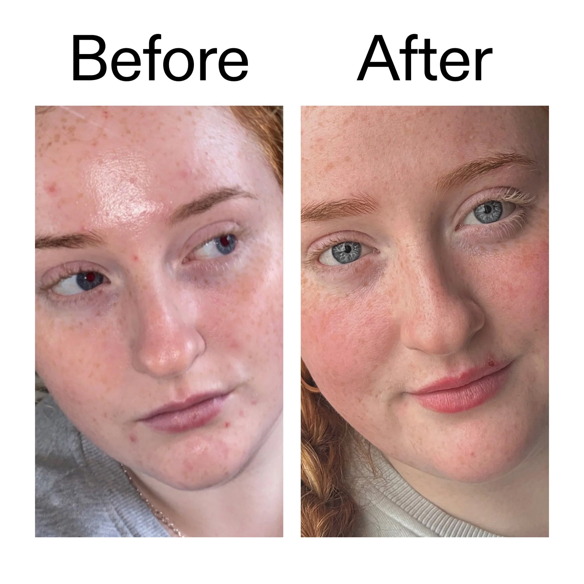 vitamin-b-c-and-e-moisturizer-z7 Vitamin_B_C_and_E_Moisturizer_Before_After_2000x2000_b0781a76-5ad2-4be9-95b8-ef92b356833c.jpg